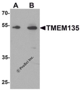 Western blot analysis of TMEM135 in rat liver tissue lysate with TMEM135 antibody at (A) 1 and (B) 2 μg/mL.