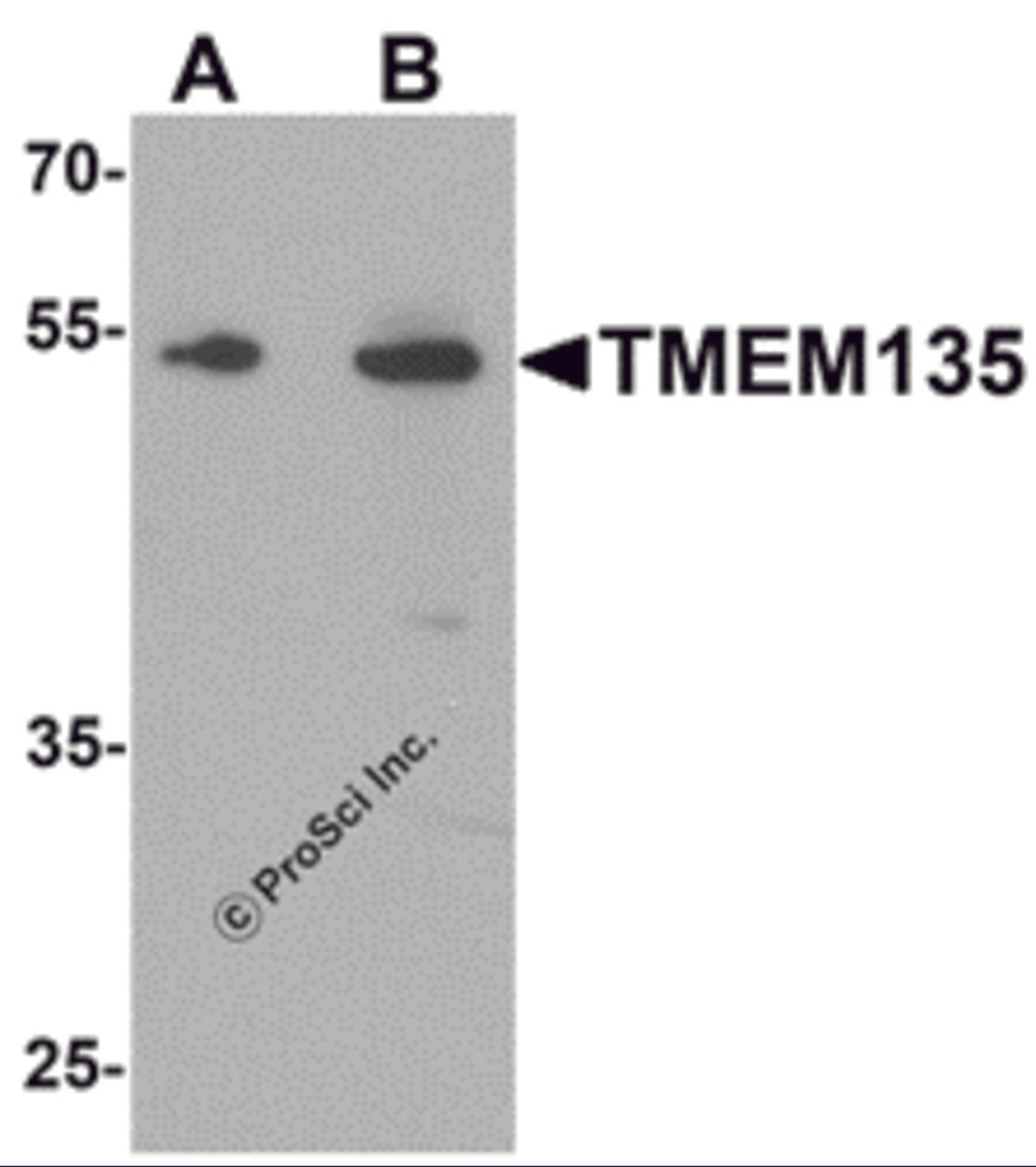 Western blot analysis of TMEM135 in rat liver tissue lysate with TMEM135 antibody at (A) 1 and (B) 2 μg/mL.