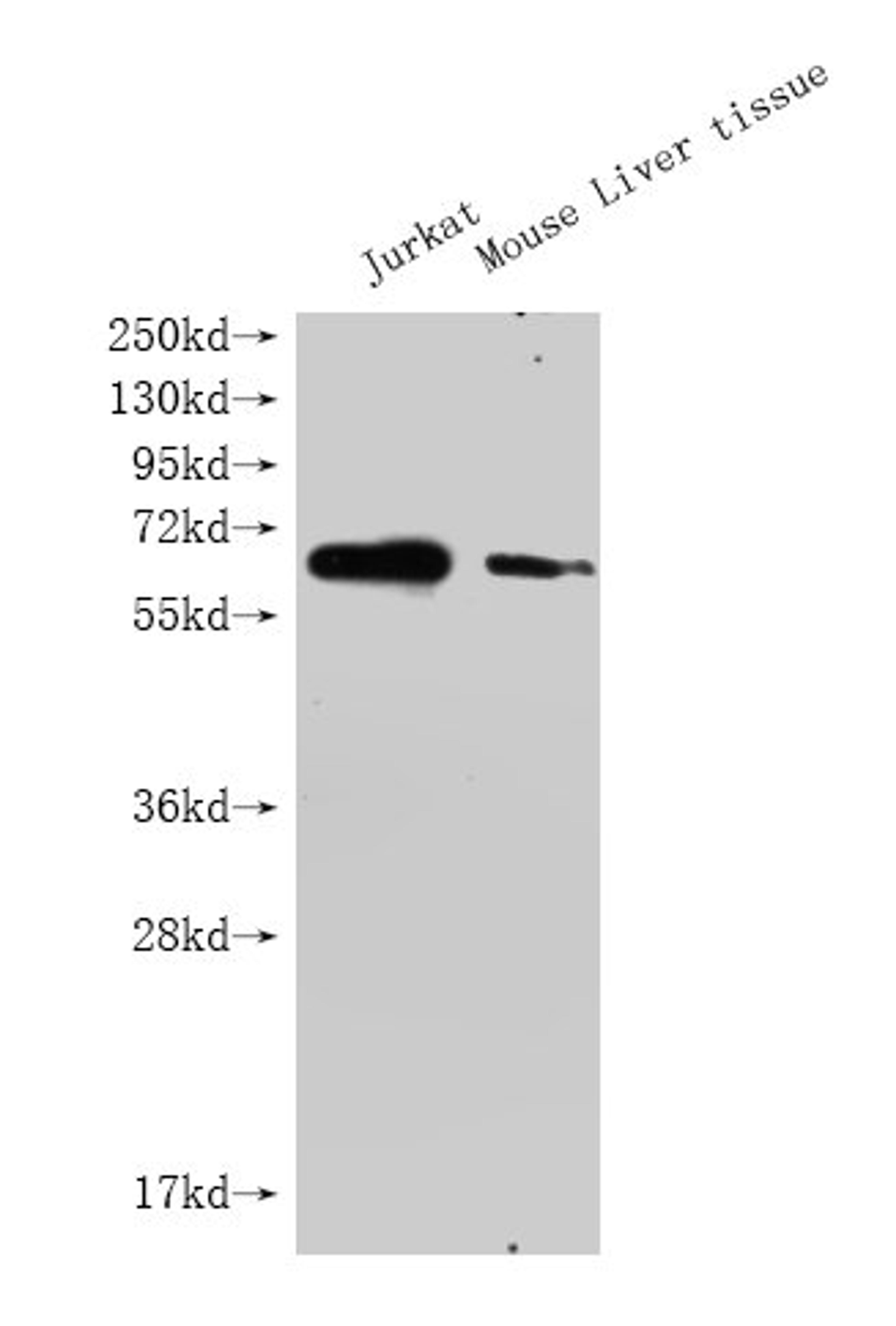 Western Blot. Positive WB detected in: GPC3 antibody at 1:1000. Lane 1: Jurkat whole cell lysate. Lane 2: Mouse liver tissue. Secondary. Goat polyclonal to Mouse IgG at 1/20000 dilution. Predicted band size: 65-70KDa. Observed band size: 65-70 KDa. Exposure time: 5min