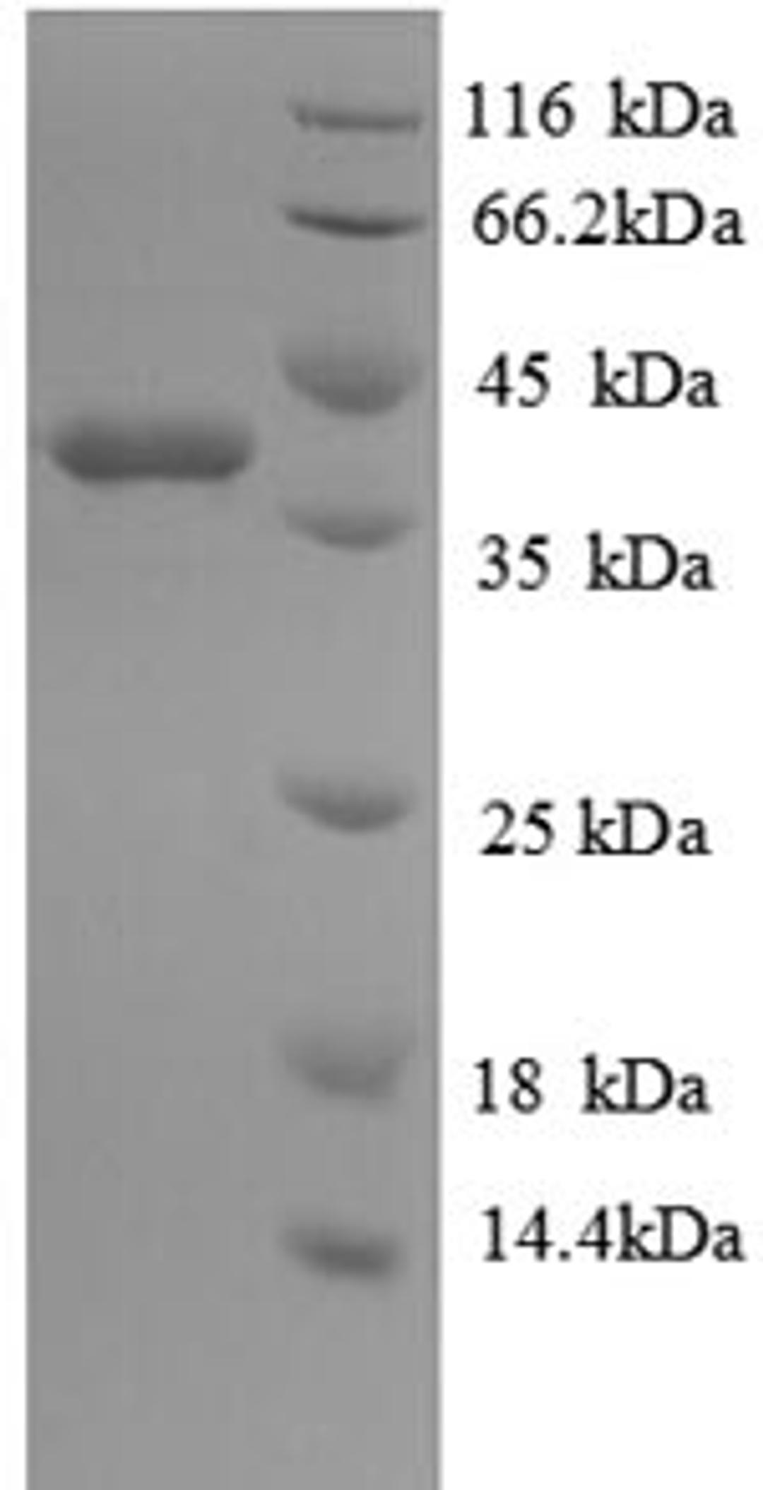 (Tris-Glycine gel) Discontinuous SDS-PAGE (reduced) with 5% enrichment gel and 15% separation gel.