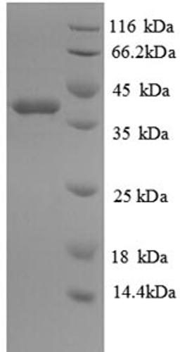 (Tris-Glycine gel) Discontinuous SDS-PAGE (reduced) with 5% enrichment gel and 15% separation gel.