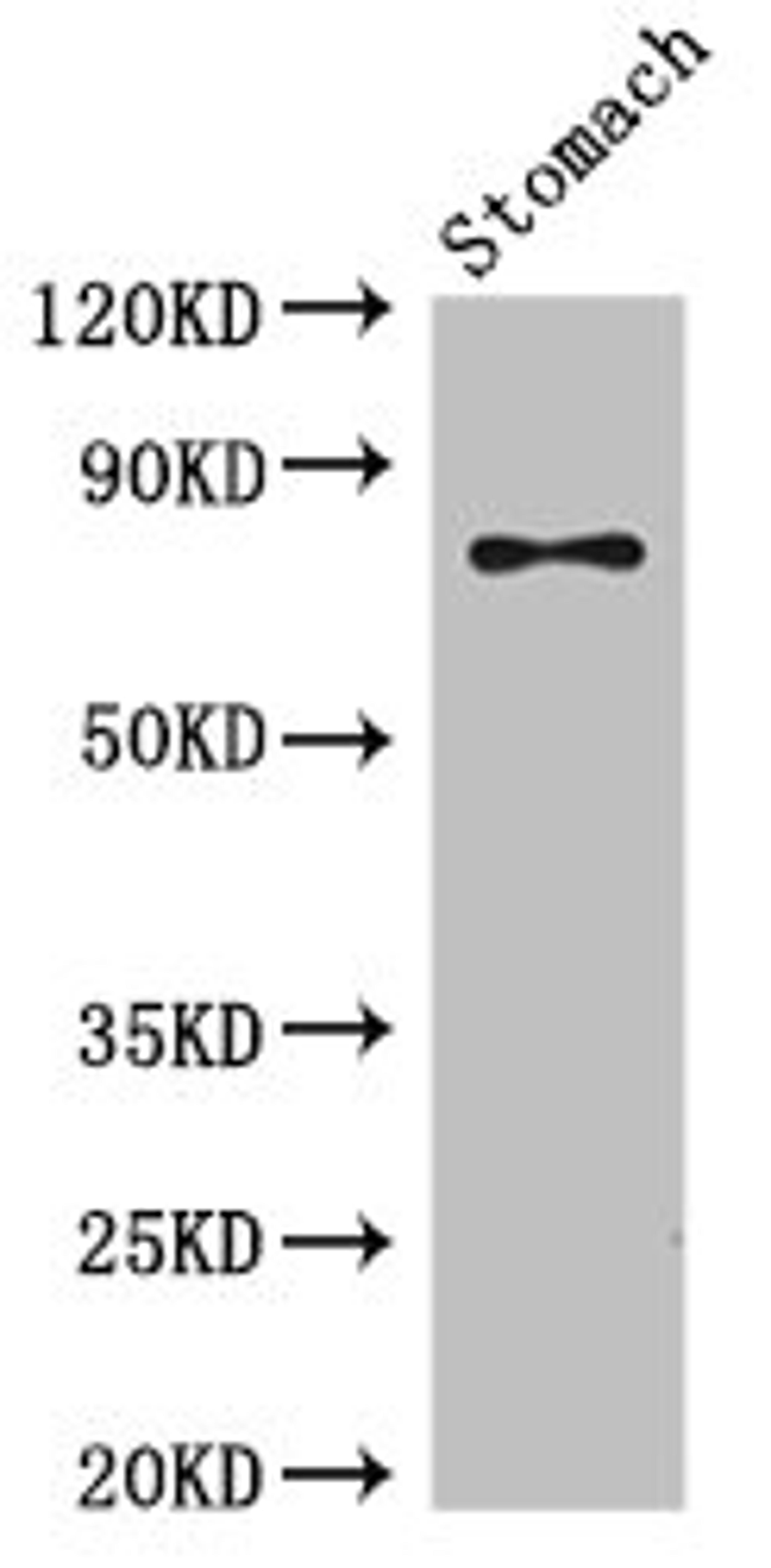 Western Blot. Positive WB detected in: Mouse stomach tissue. All lanes: SCIN antibody at 3.5µg/ml. Secondary. Goat polyclonal to rabbit IgG at 1/50000 dilution. Predicted band size: 81, 66, 53 kDa. Observed band size: 81 kDa