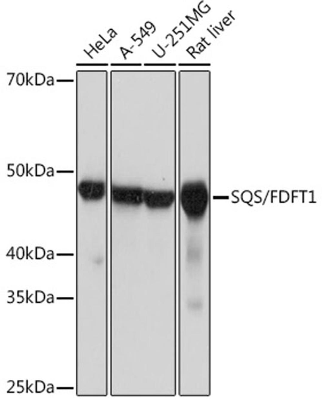 Western blot - SQS/FDFT1 Rabbit mAb (A4651)