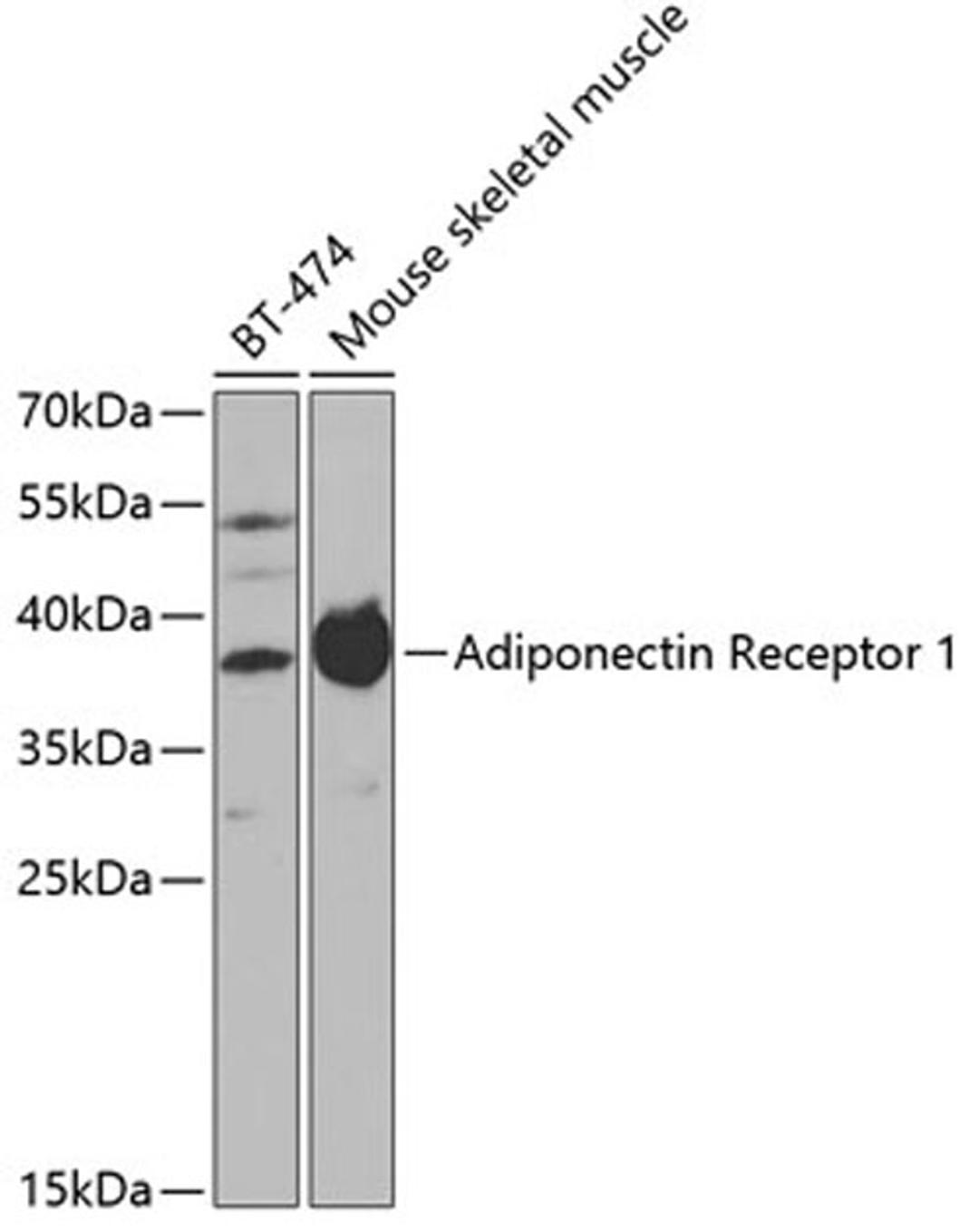 Western blot - Adiponectin Receptor 1 antibody (A1509)