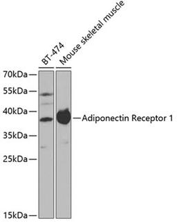 Western blot - Adiponectin Receptor 1 antibody (A1509)