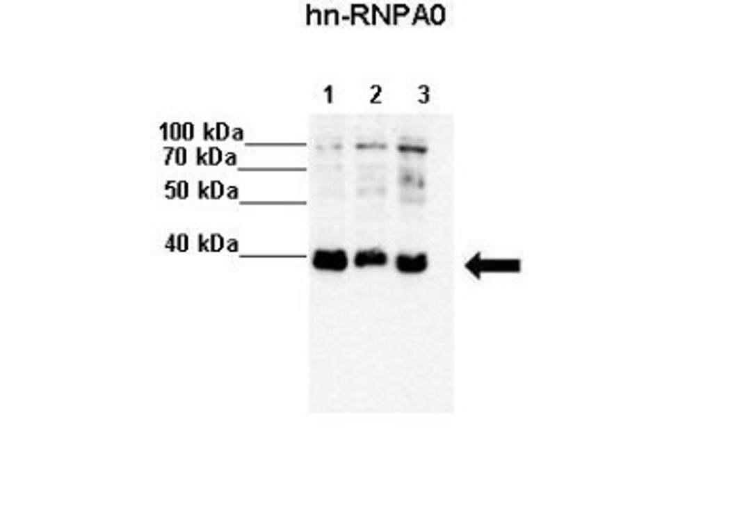 Western Blot: HNRNPA0 Antibody [NBP1-57275] - Lanes: Lane 1 : 20 ug HeLa S3 lysate Lane 2: 20 ug MCF7 lysate Lane 3: 20 ug K562 lysate Primary, Antibody Dilution: 1 : 4000 Secondary Antibody: Anti-rabbit-HRP Secondary, Antibody Dilution: 1 : 5000 Gene name: HNRPA0.