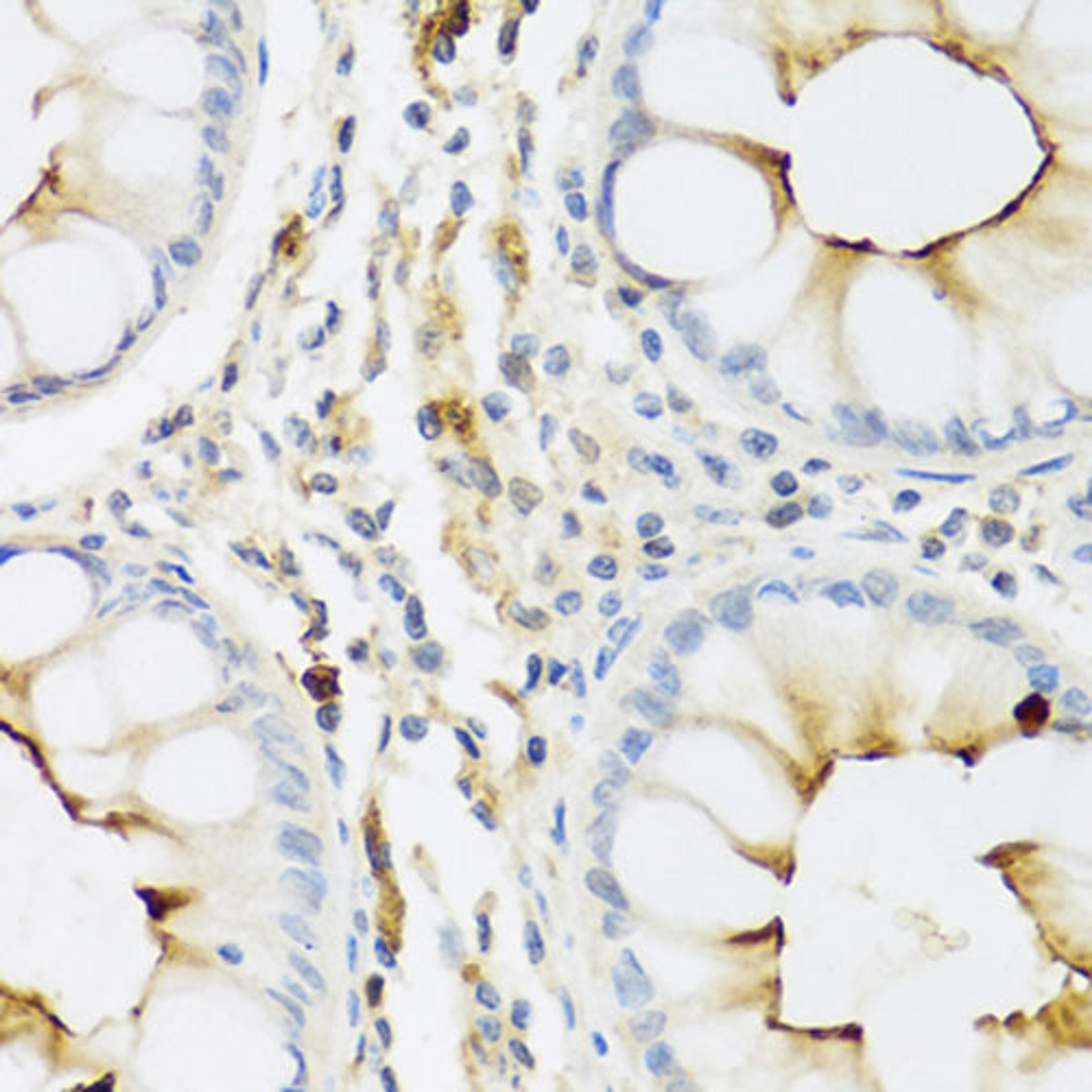 Immunohistochemistry  - RNASE3 antibody (A1854)