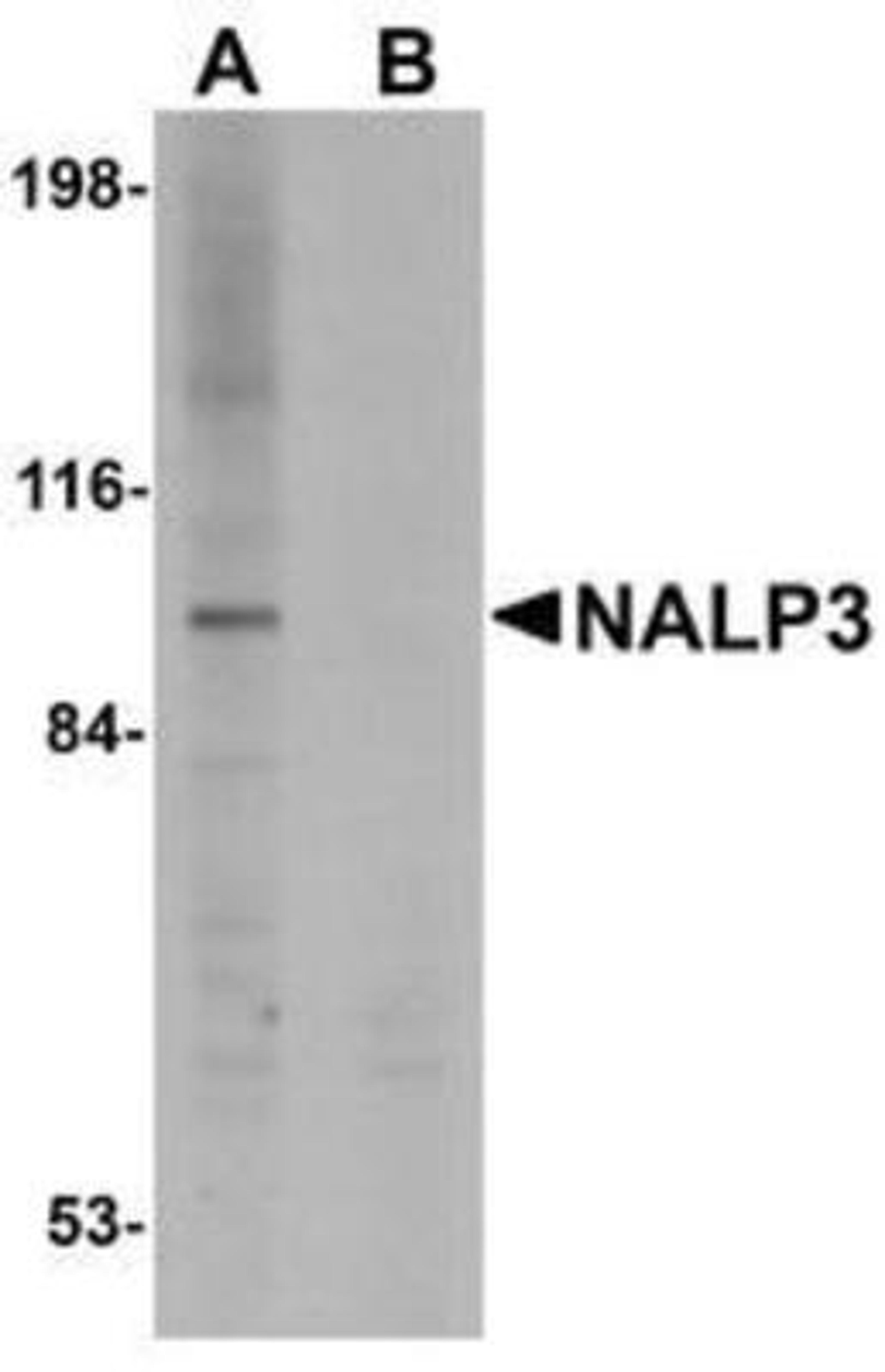 Western Blot: NALP3 Antibody [NBP1-77080] - K562 cell lysate with NALP3 antibody at 1 ug/mL (A) in the absence and (B) in the presence of blocking peptide.