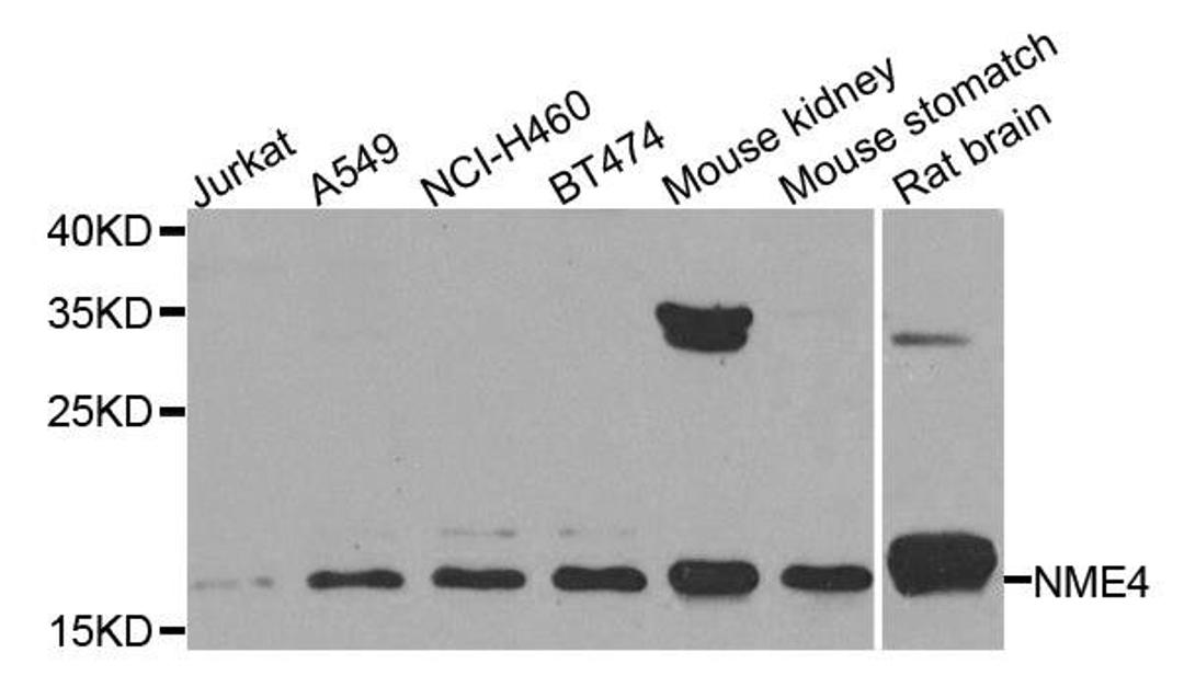 Western blot analysis of extracts of various cell lines using NME4 antibody