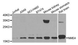 Western blot analysis of extracts of various cell lines using NME4 antibody