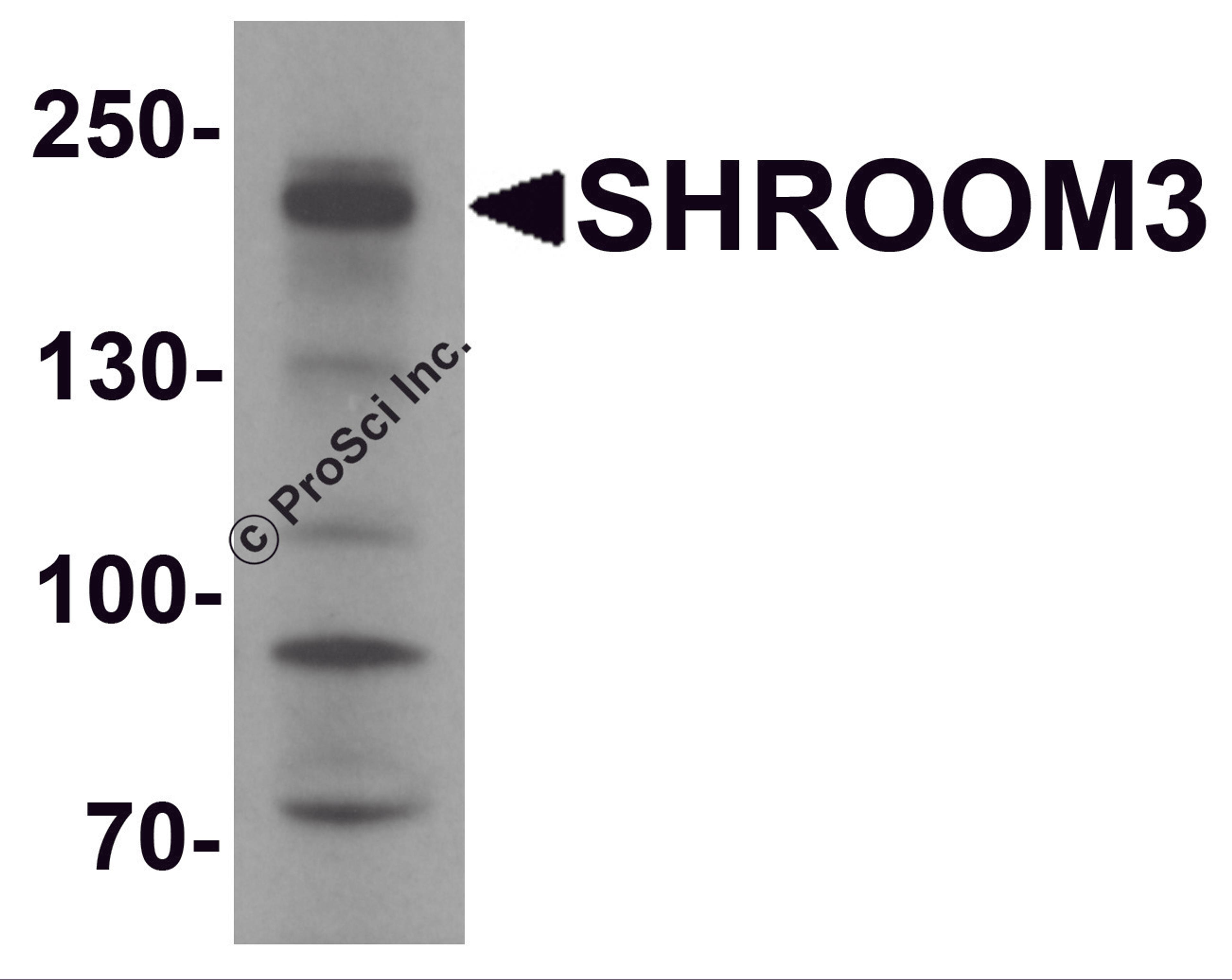 Western blot analysis of SHROOM3 in SK-N-SH cell lysate with SHROOM3 antibody at 1 μg/mL.