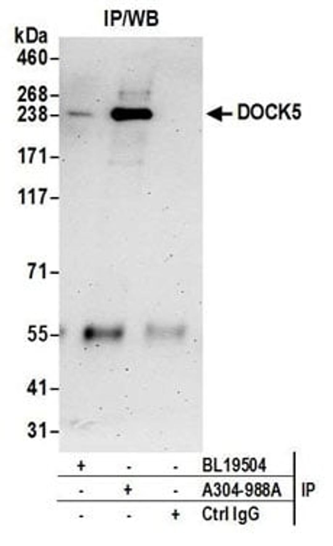 Detection of human DOCK5 by western blot of immunoprecipitates.