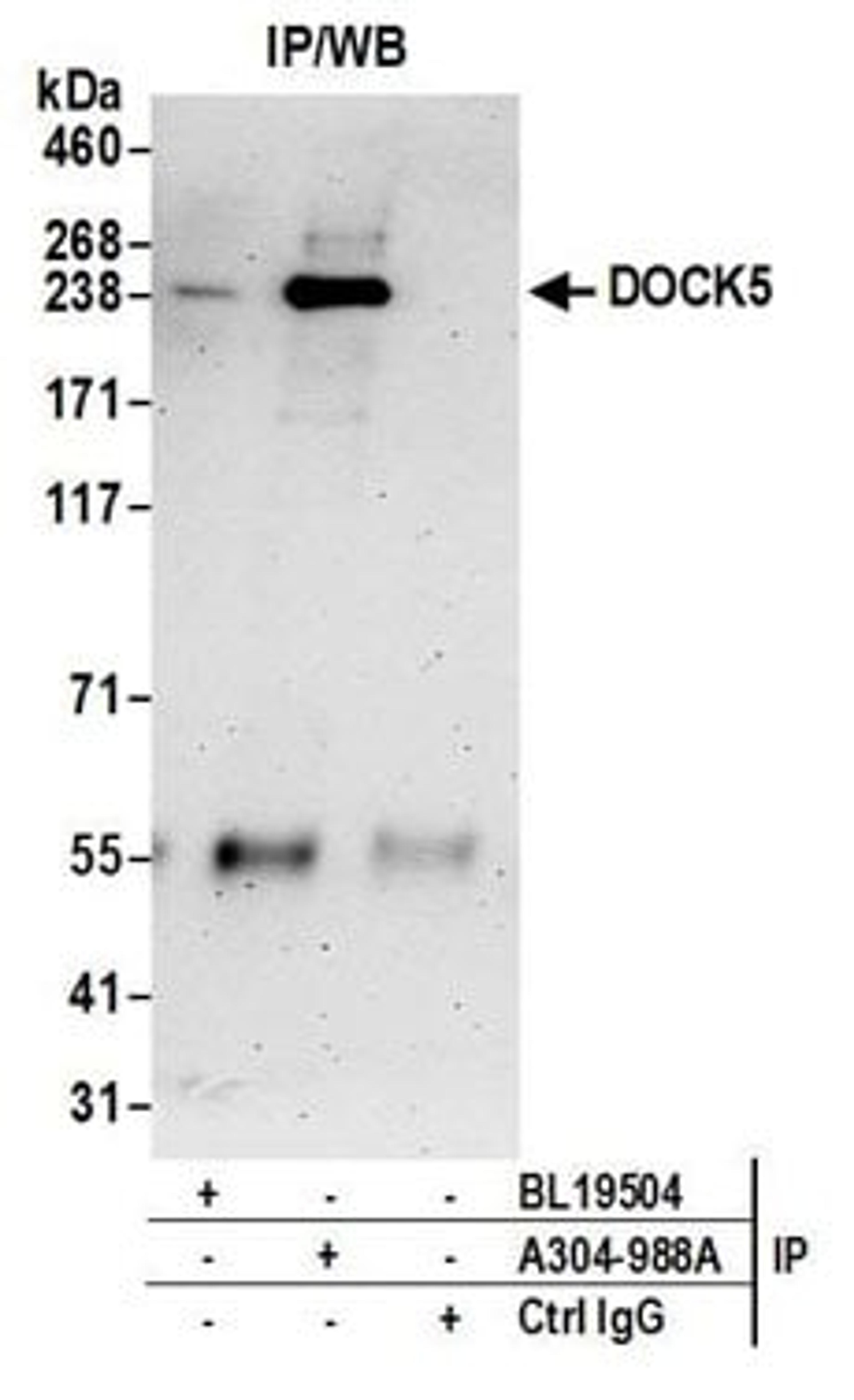 Detection of human DOCK5 by western blot of immunoprecipitates.