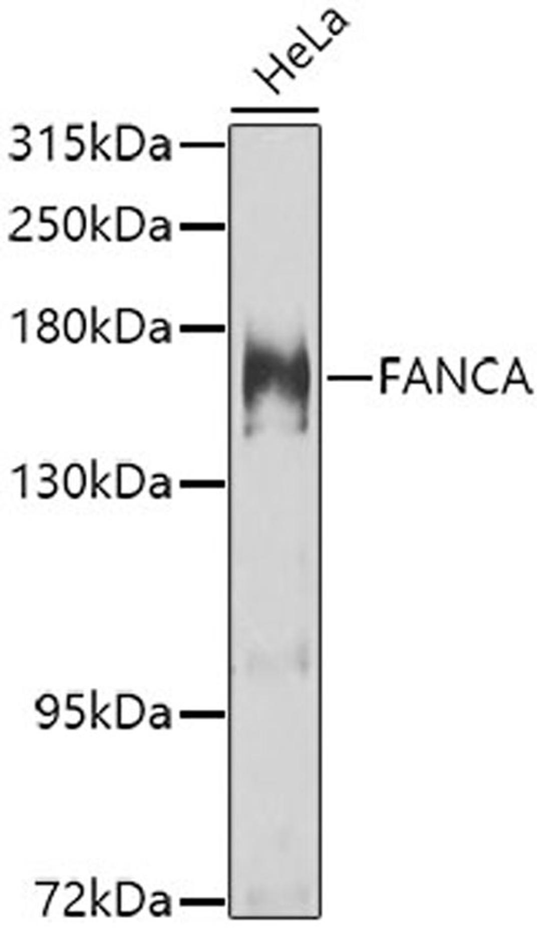 Western blot - FANCA antibody (A7671)