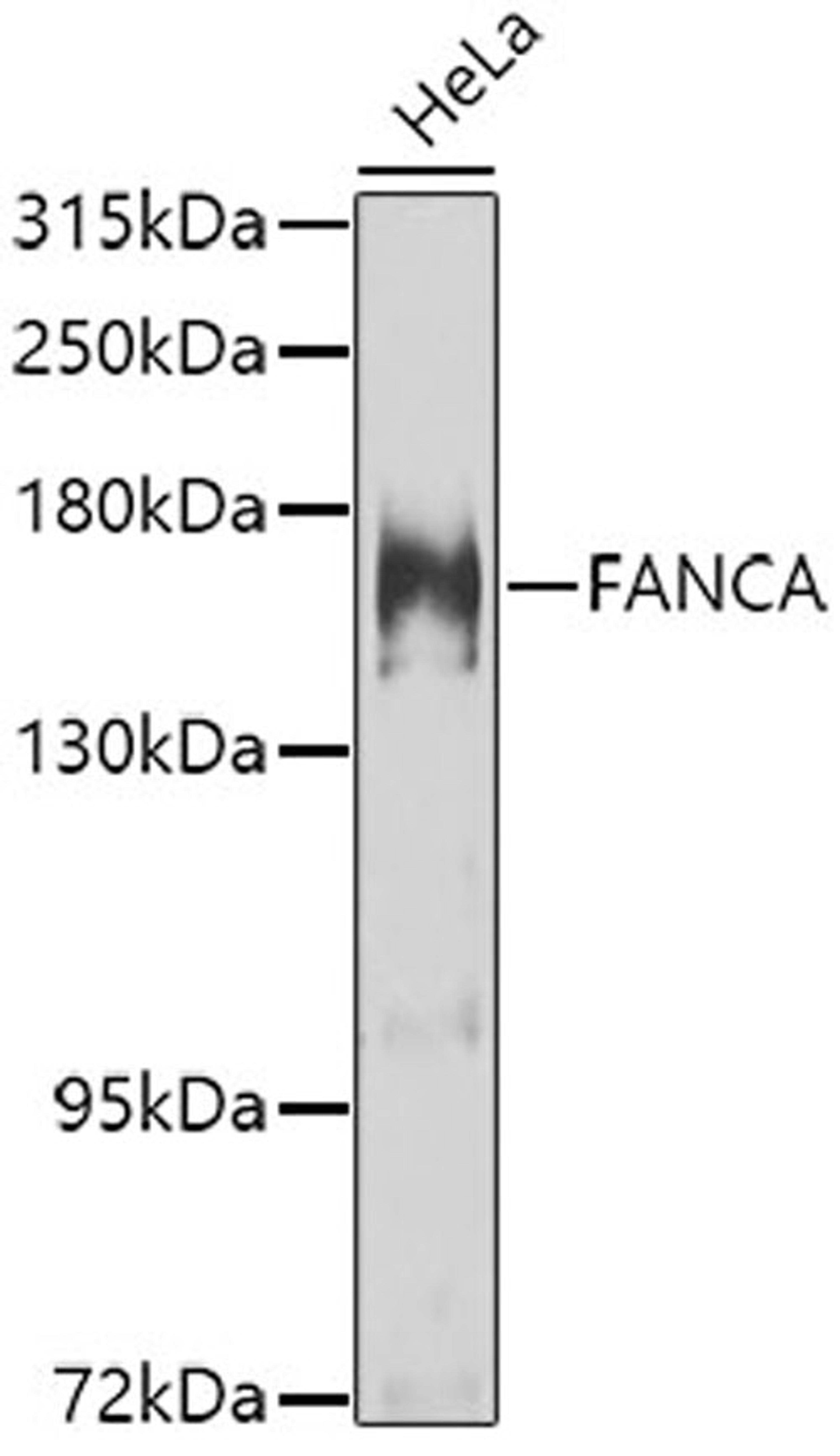 Western blot - FANCA antibody (A7671)