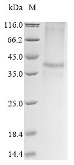 (Tris-Glycine gel) Discontinuous SDS-PAGE (reduced) with 5% enrichment gel and 15% separation gel.
