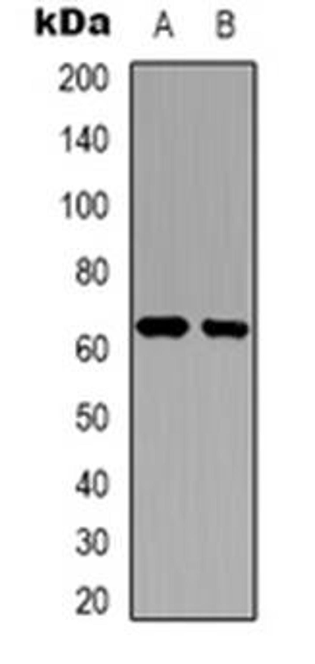 Western blot analysis of PWWP2B expression in A431 (Lane 1), U2OS (Lane 2) whole cell lysates using PWWP2B antibody