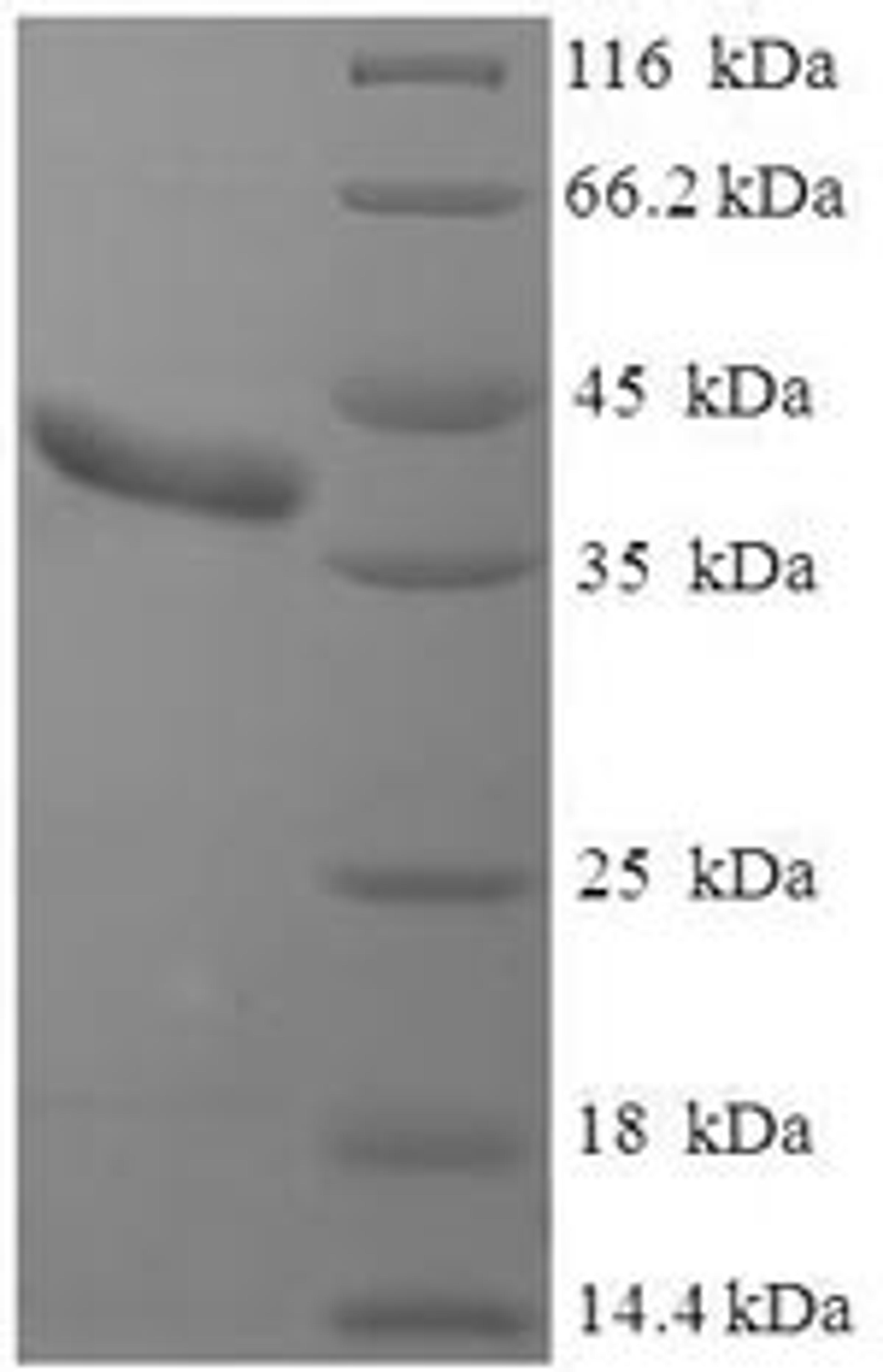 (Tris-Glycine gel) Discontinuous SDS-PAGE (reduced) with 5% enrichment gel and 15% separation gel.