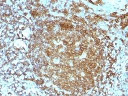 IHC test of FFPE human tonsil probed with CD45RA antibody