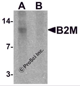 Western blot analysis of B2M in SK-N-SH cell lysate with B2M antibody at 1 &#956;g/mL in (A) the absence and (B) the presence of blocking peptide.