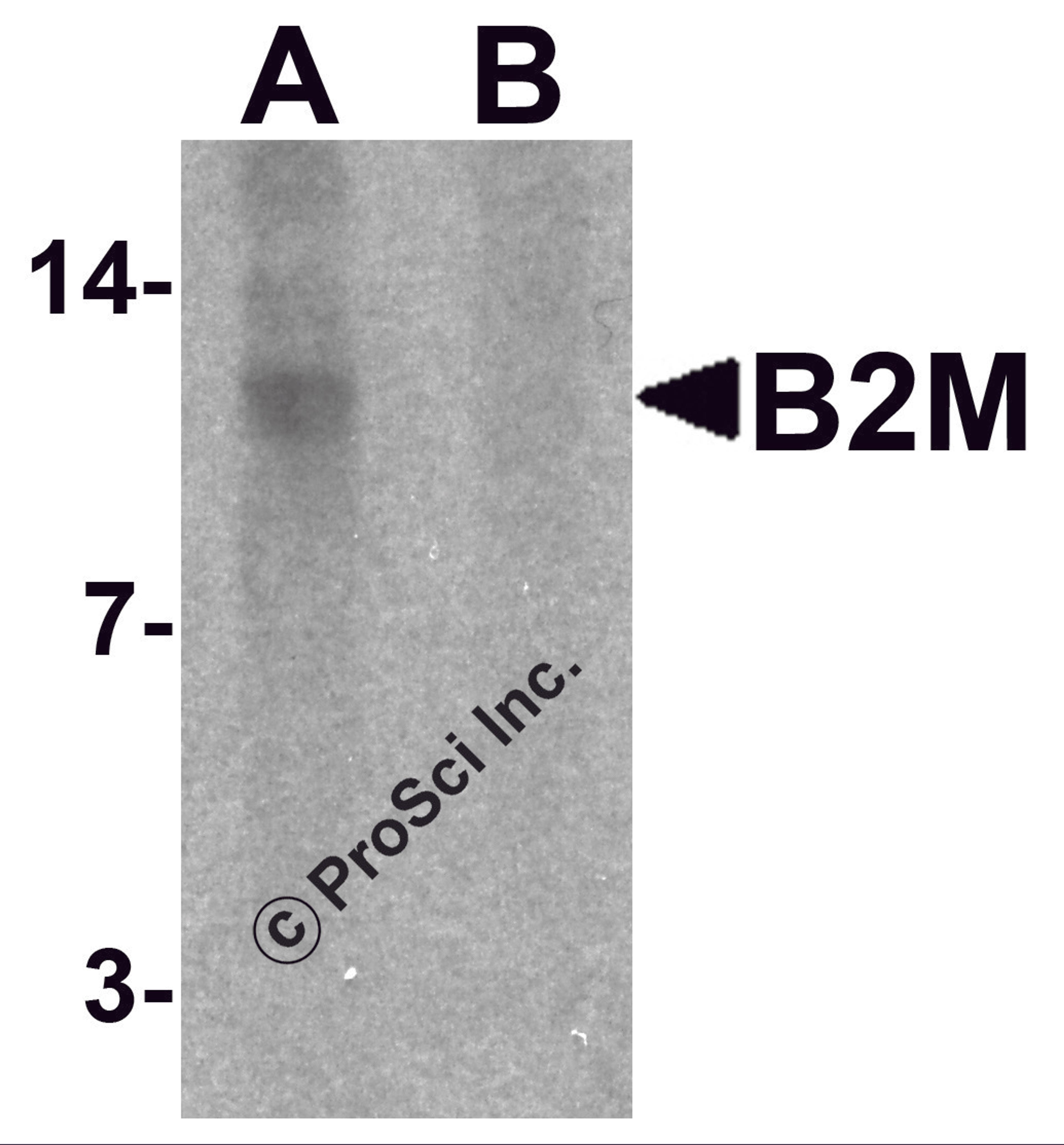 Western blot analysis of B2M in SK-N-SH cell lysate with B2M antibody at 1 &#956;g/mL in (A) the absence and (B) the presence of blocking peptide.