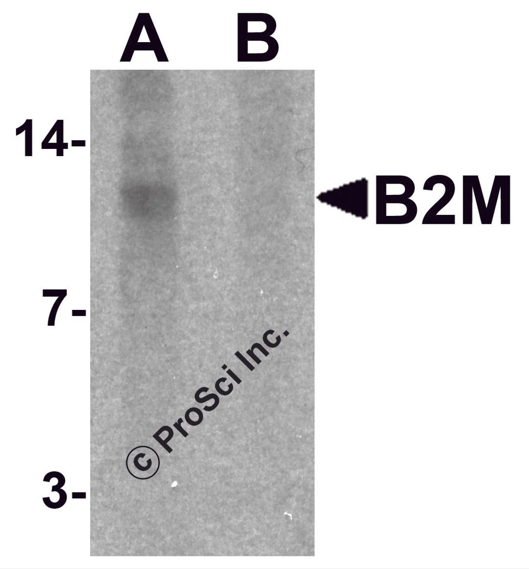 Western blot analysis of B2M in SK-N-SH cell lysate with B2M antibody at 1 μg/mL in (A) the absence and (B) the presence of blocking peptide.