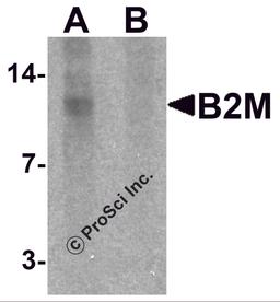 Western blot analysis of B2M in SK-N-SH cell lysate with B2M antibody at 1 μg/mL in (A) the absence and (B) the presence of blocking peptide.
