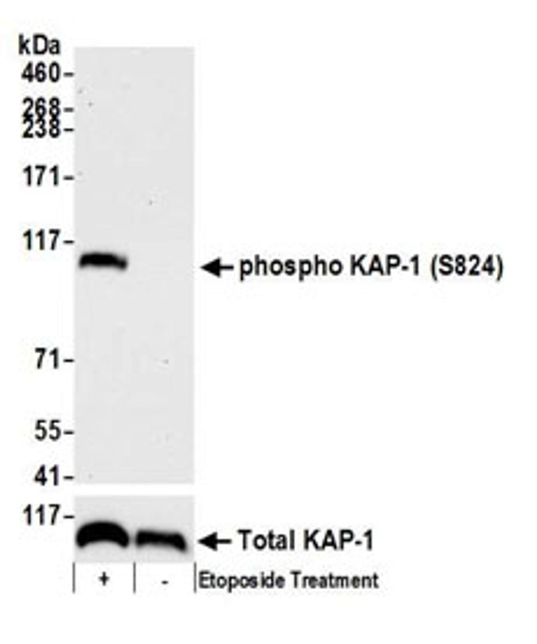 Detection of mouse Phospho KAP-1 (S824) by western blot.