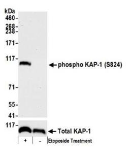 Detection of mouse Phospho KAP-1 (S824) by western blot.