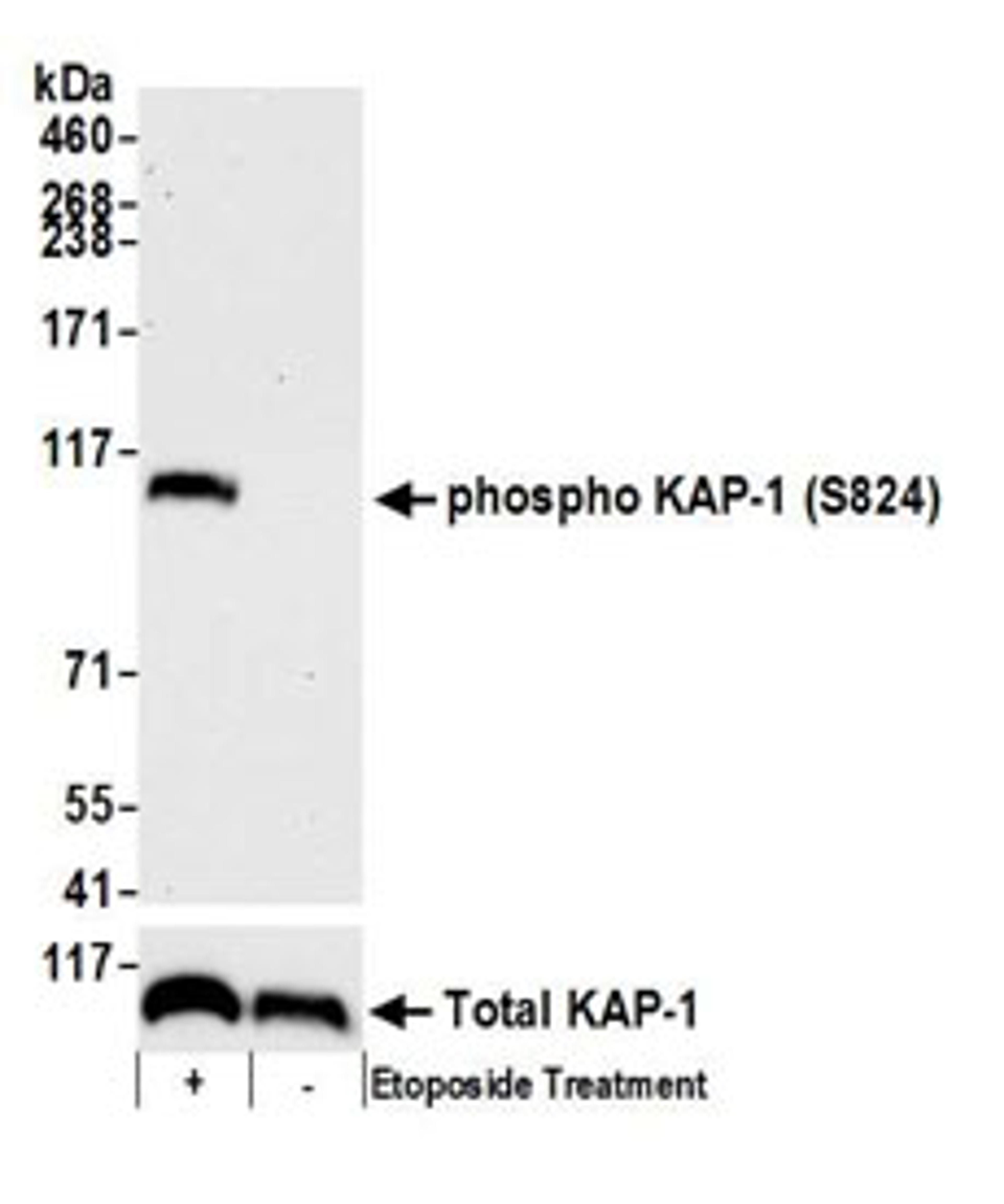 Detection of mouse Phospho KAP-1 (S824) by western blot.