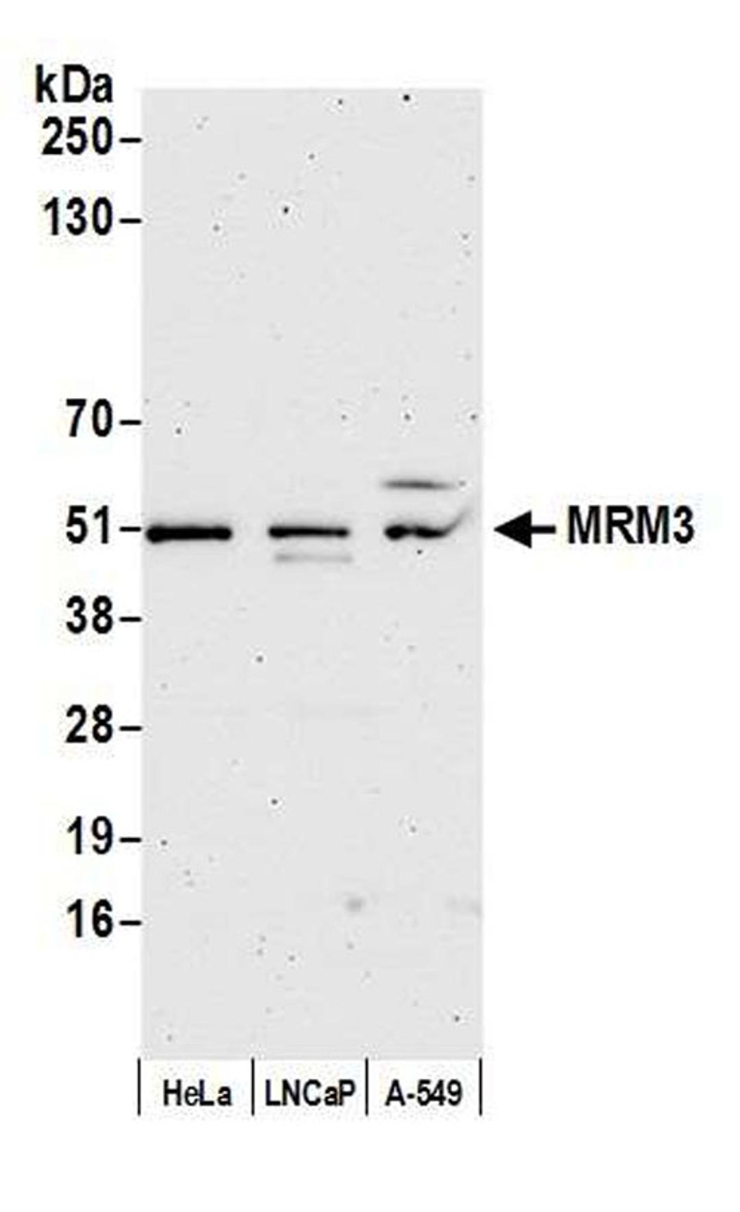 Detection of human MRM3 by WB.