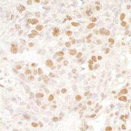 Detection of human BRD4 by immunohistochemistry.