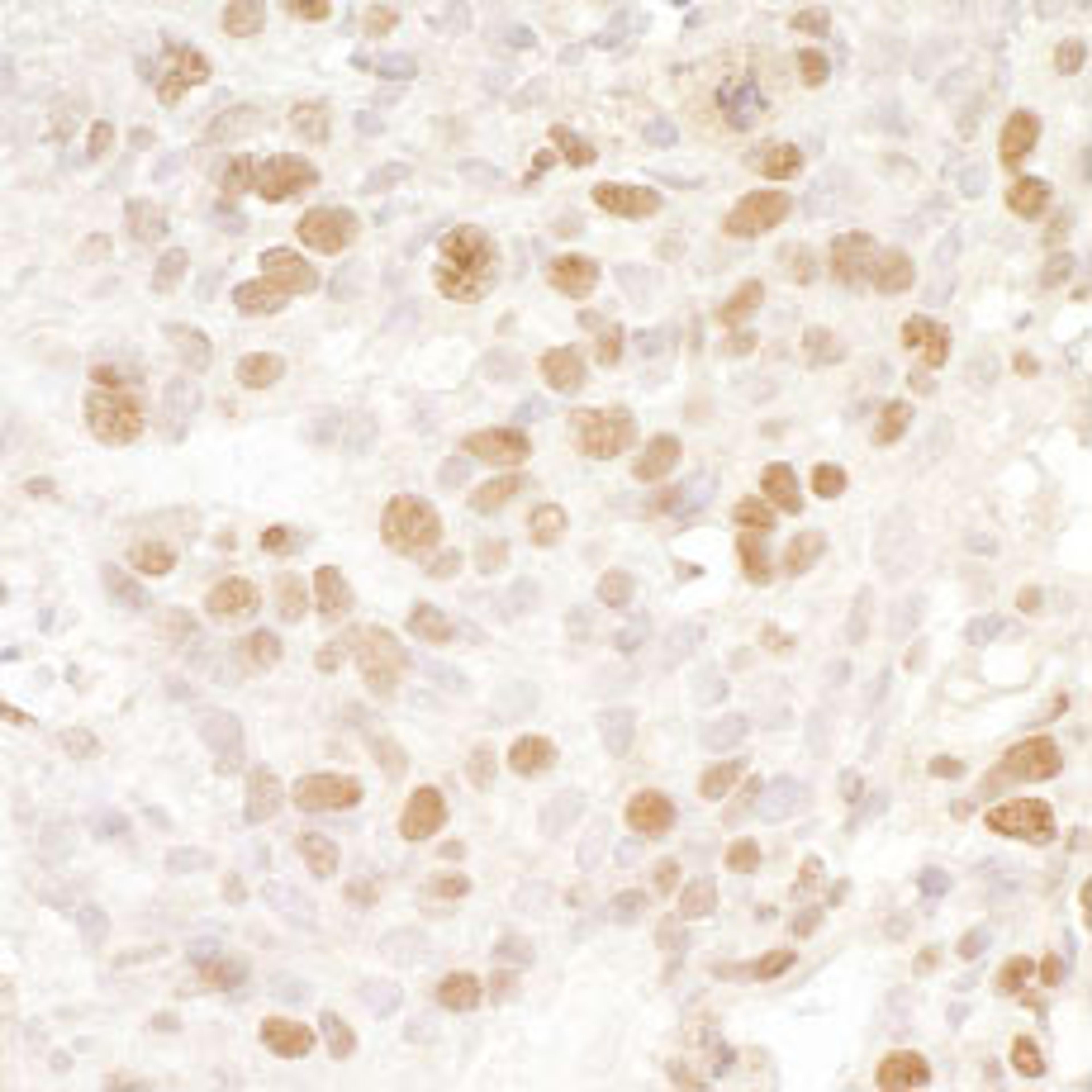 Detection of human BRD4 by immunohistochemistry.