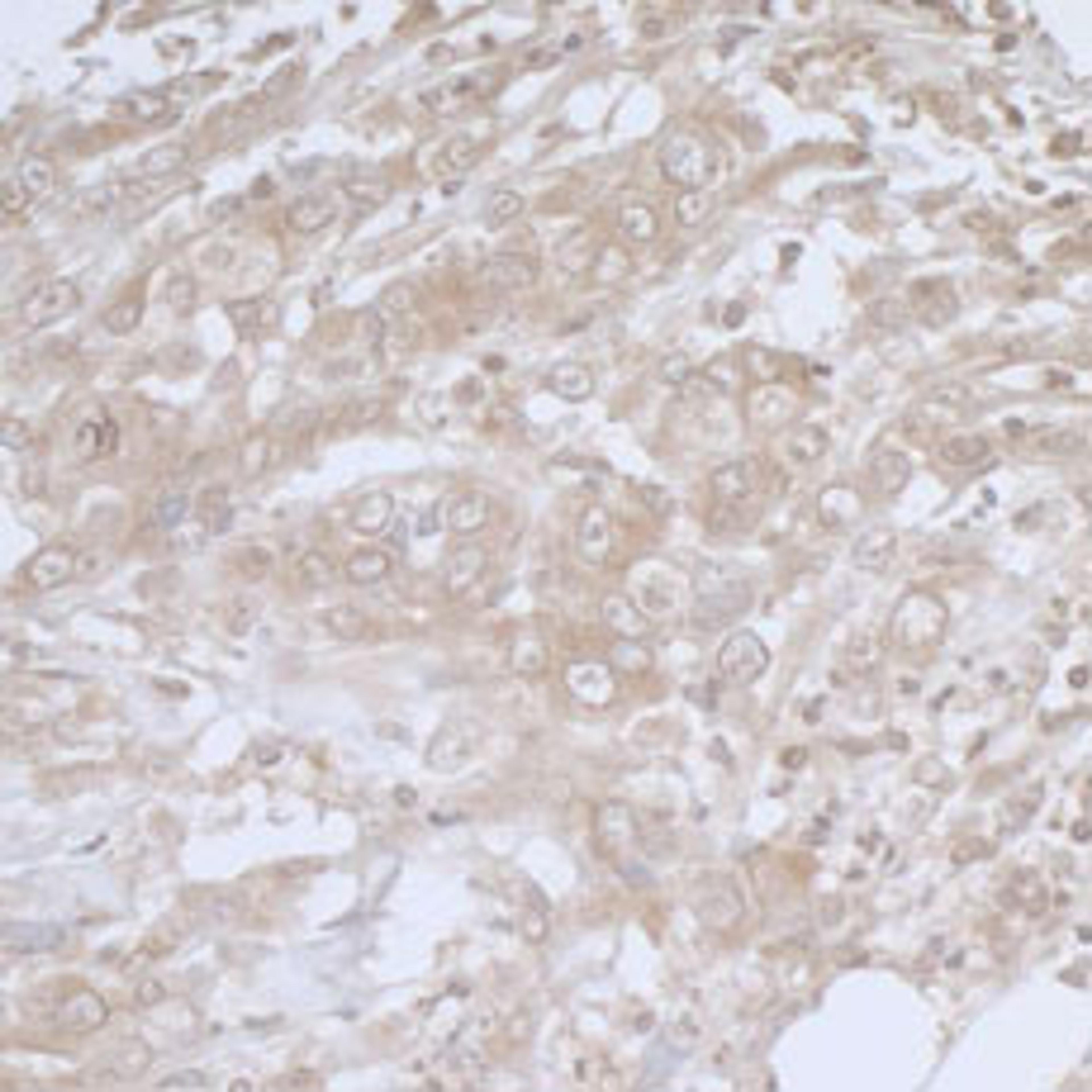 Detection of human BIRC6/Apollon by immunohistochemistry.