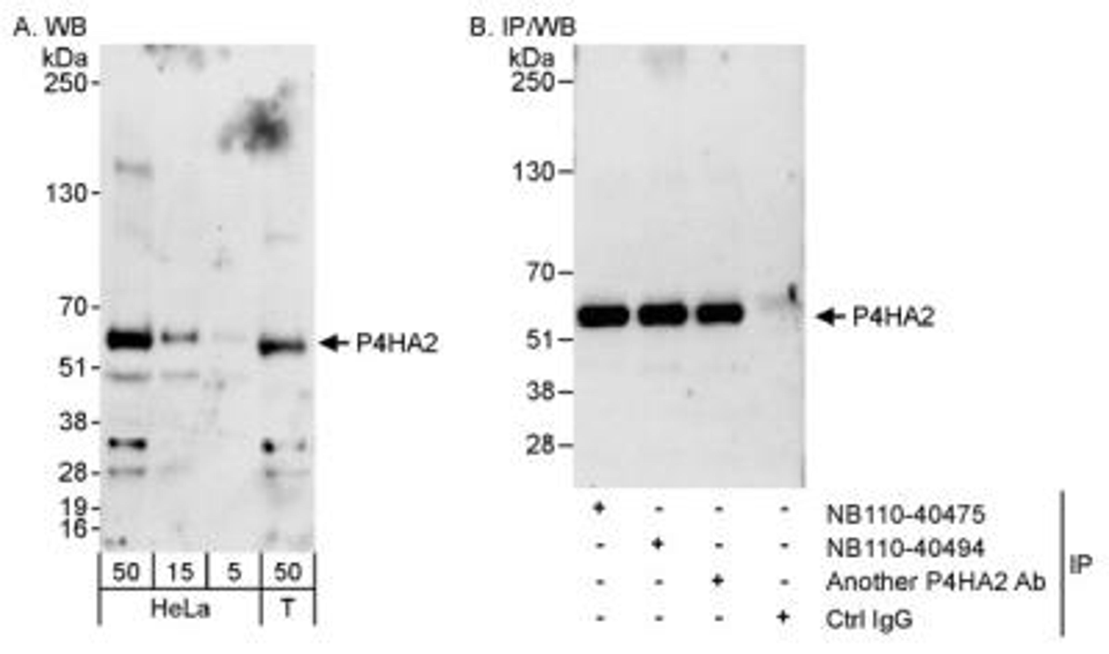 Immunoprecipitation: P4HA2 Antibody [NB110-40494] - Detection of Human P4HA2 on HeLa whole cell lysate using NB110-40494. P4HA2 was also immunoprecipitated by rabbit anti-P4HA2 antibodies NB100-40475 and another P4HA2 antibody.