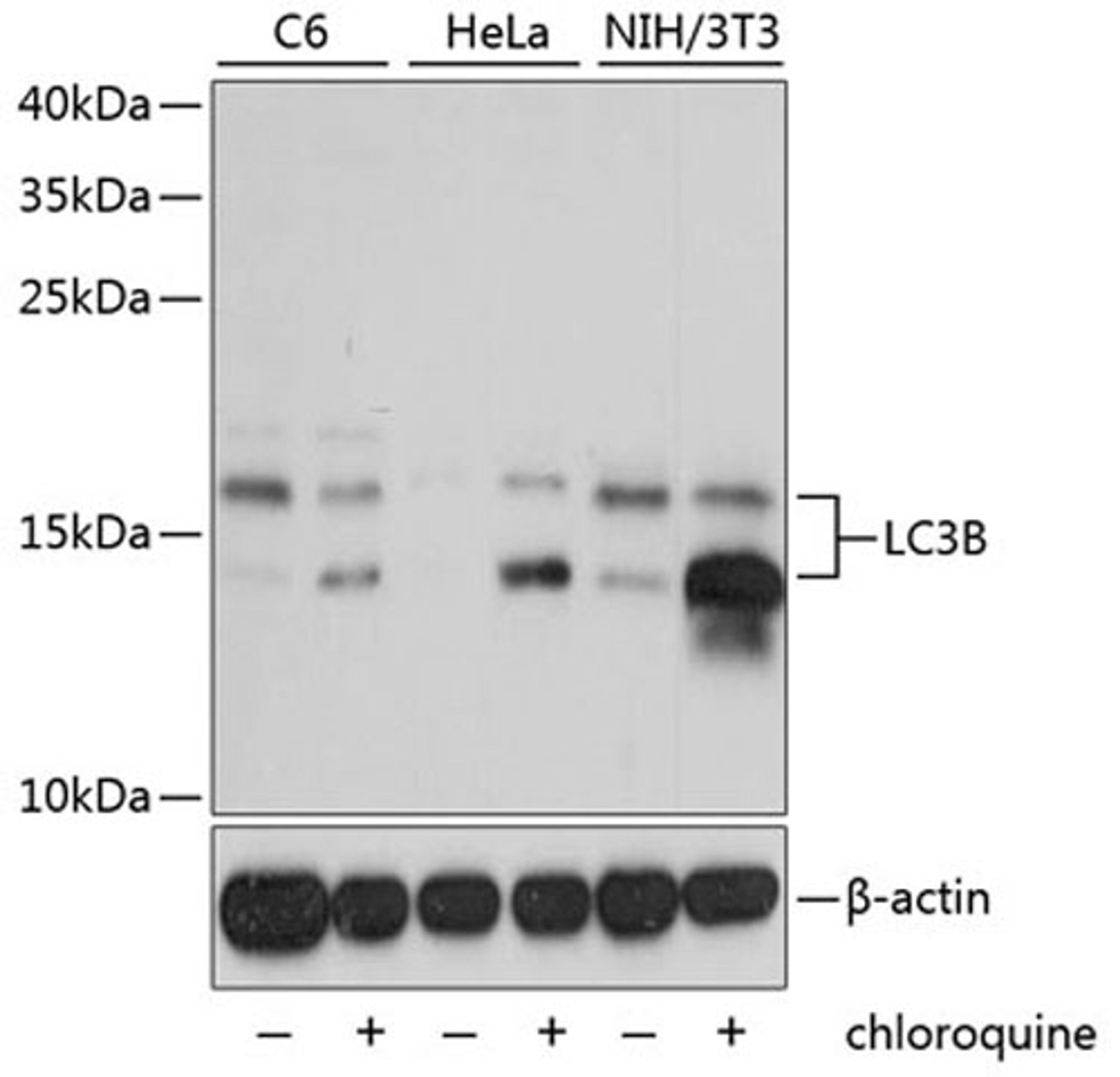 Western blot - LC3B antibody (A7198)