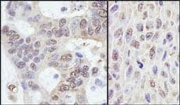 Detection of human and mouse PRKRIR by immunohistochemistry.