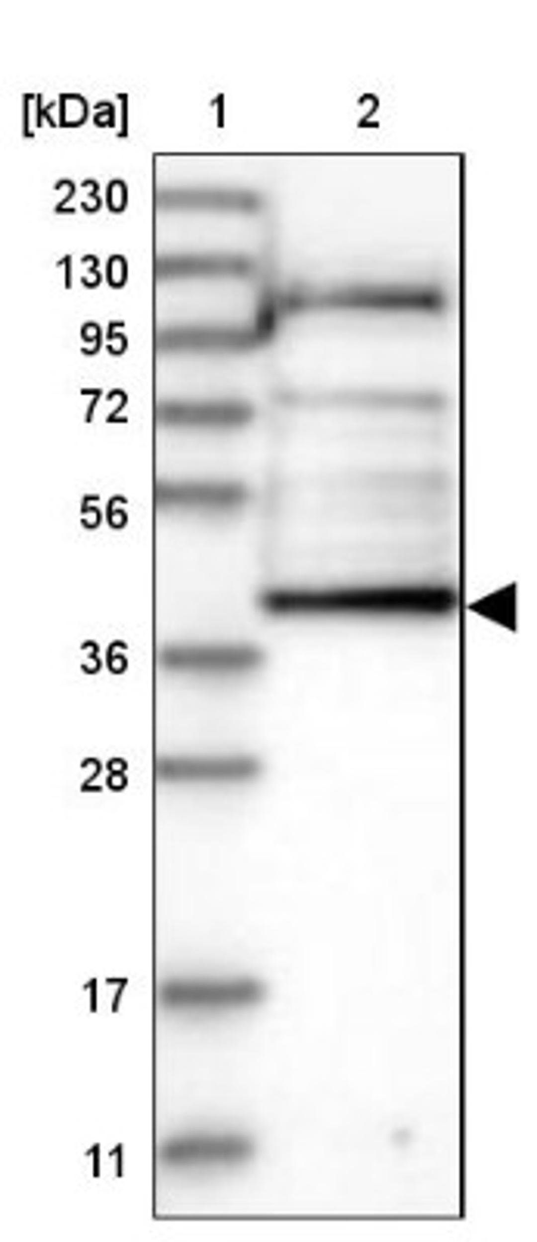 Western Blot: AADAT Antibody [NBP1-89627] - Lane 1: Marker [kDa] 230, 130, 95, 72, 56, 36, 28, 17, 11<br/>Lane 2: Human cell line RT-4