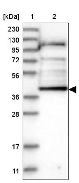 Western Blot: AADAT Antibody [NBP1-89627] - Lane 1: Marker [kDa] 230, 130, 95, 72, 56, 36, 28, 17, 11<br/>Lane 2: Human cell line RT-4