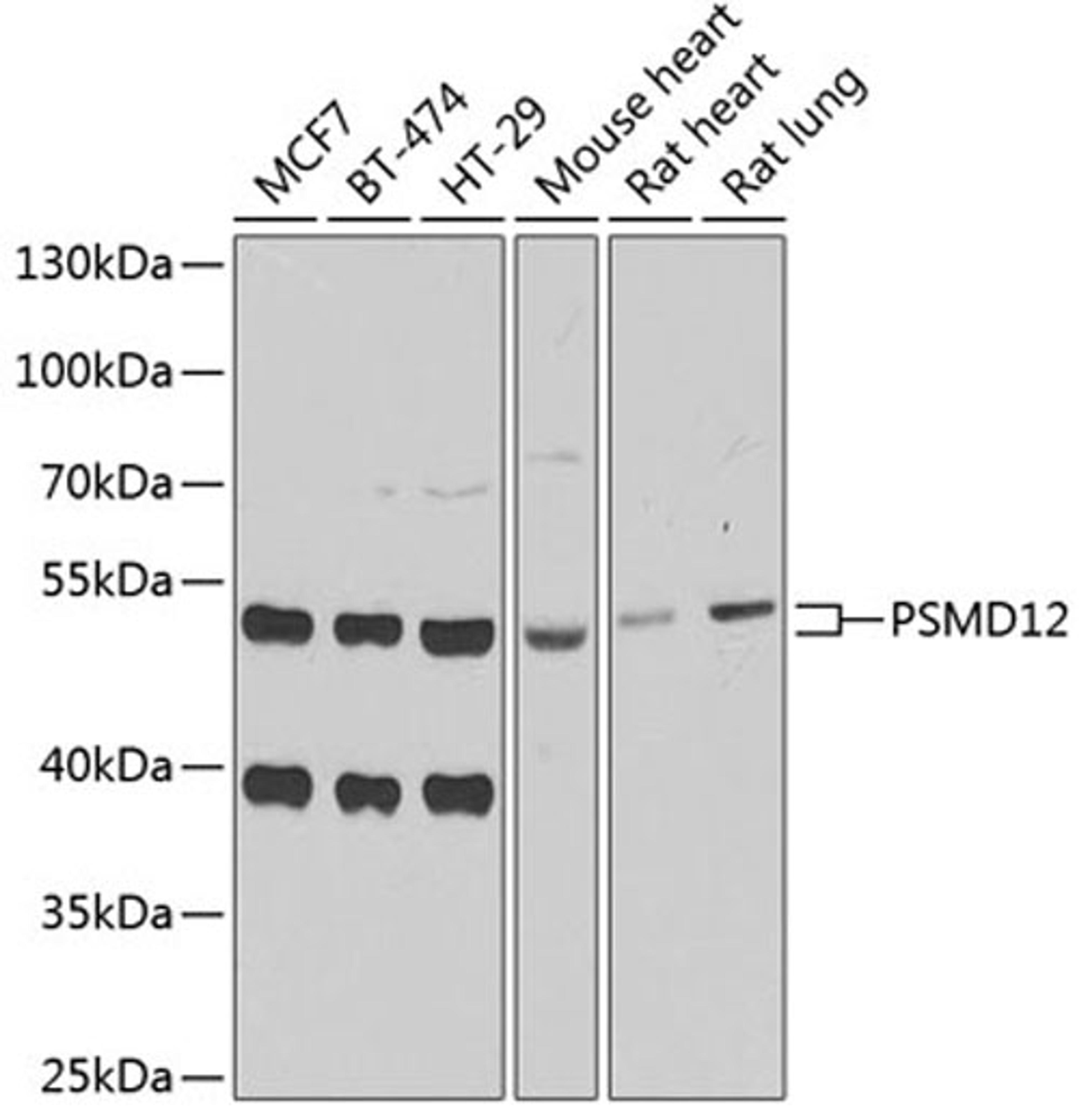 Western blot - PSMD12 antibody (A6708)