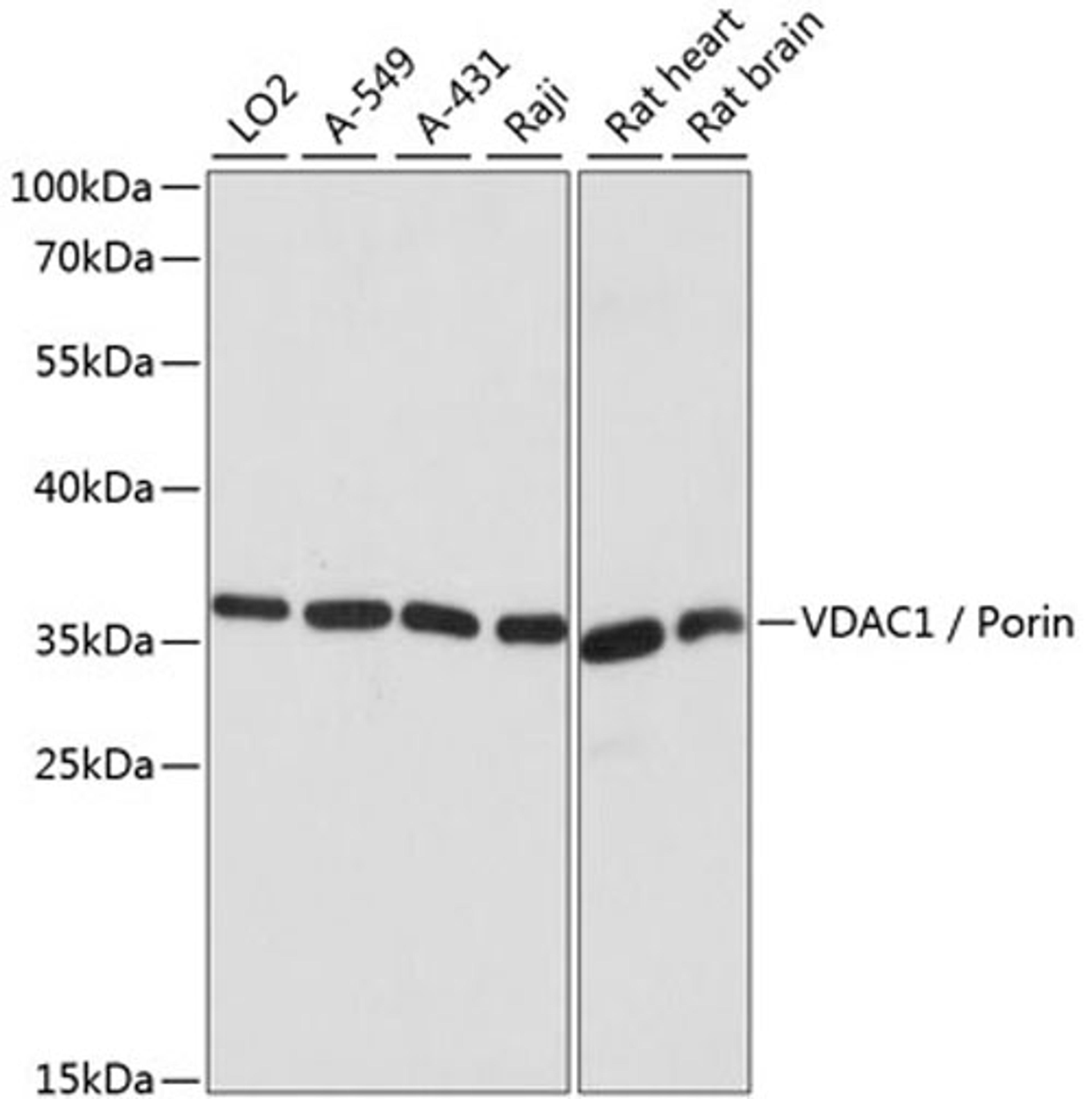 Western blot - VDAC1 / Porin antibody (A15735)