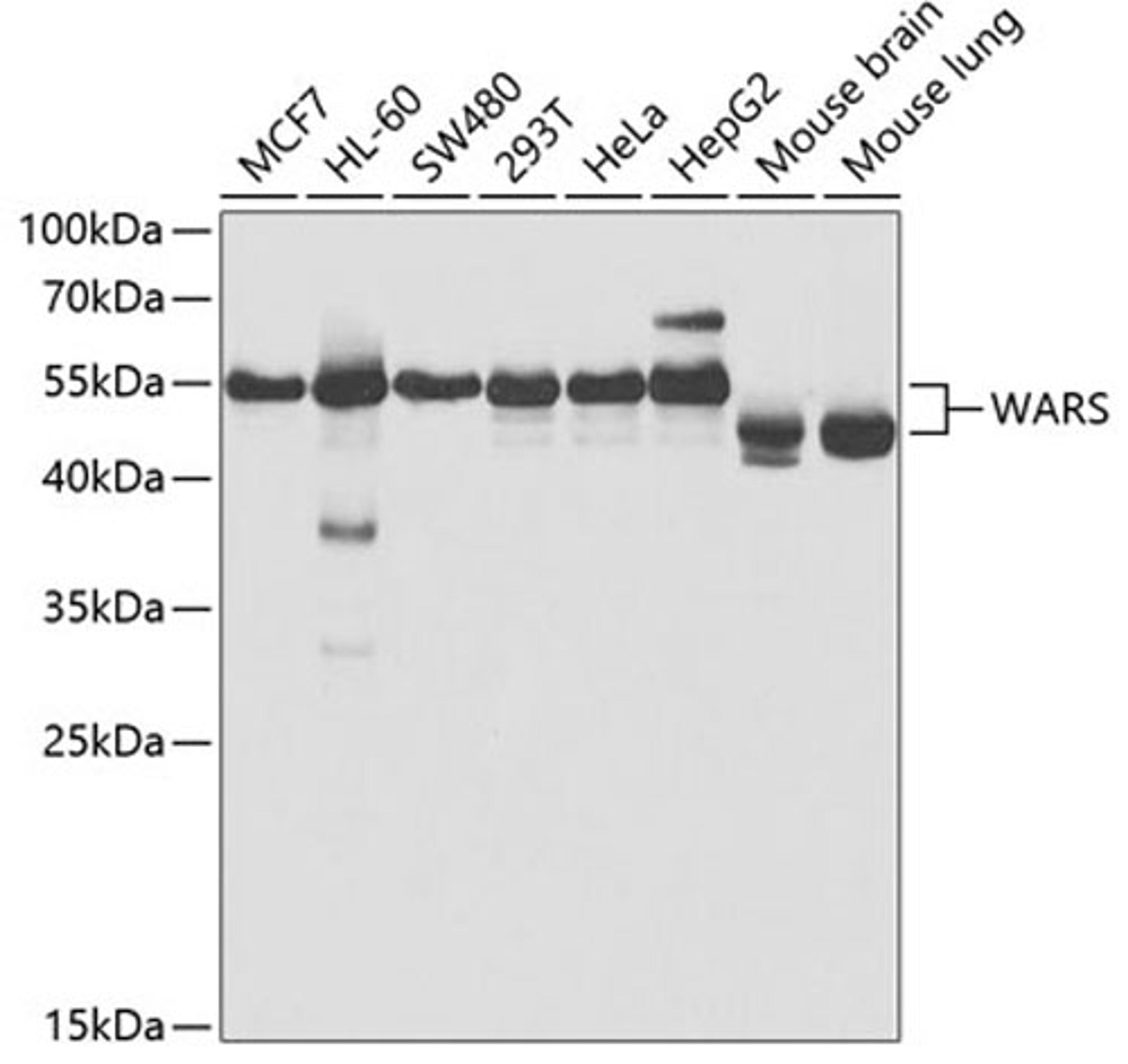 Western blot - WARS antibody (A5758)