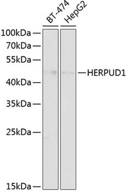 Western blot - HERPUD1 antibody (A14097)