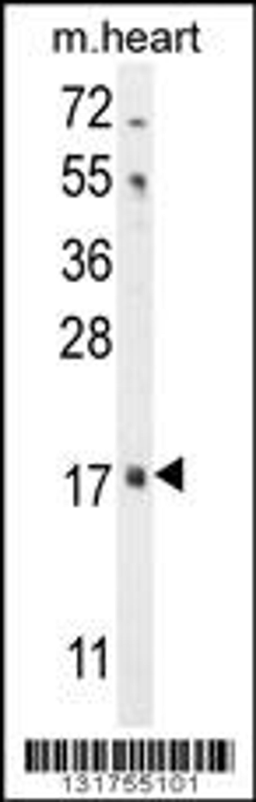 Western blot analysis in mouse heart tissue lysates (35ug/lane).