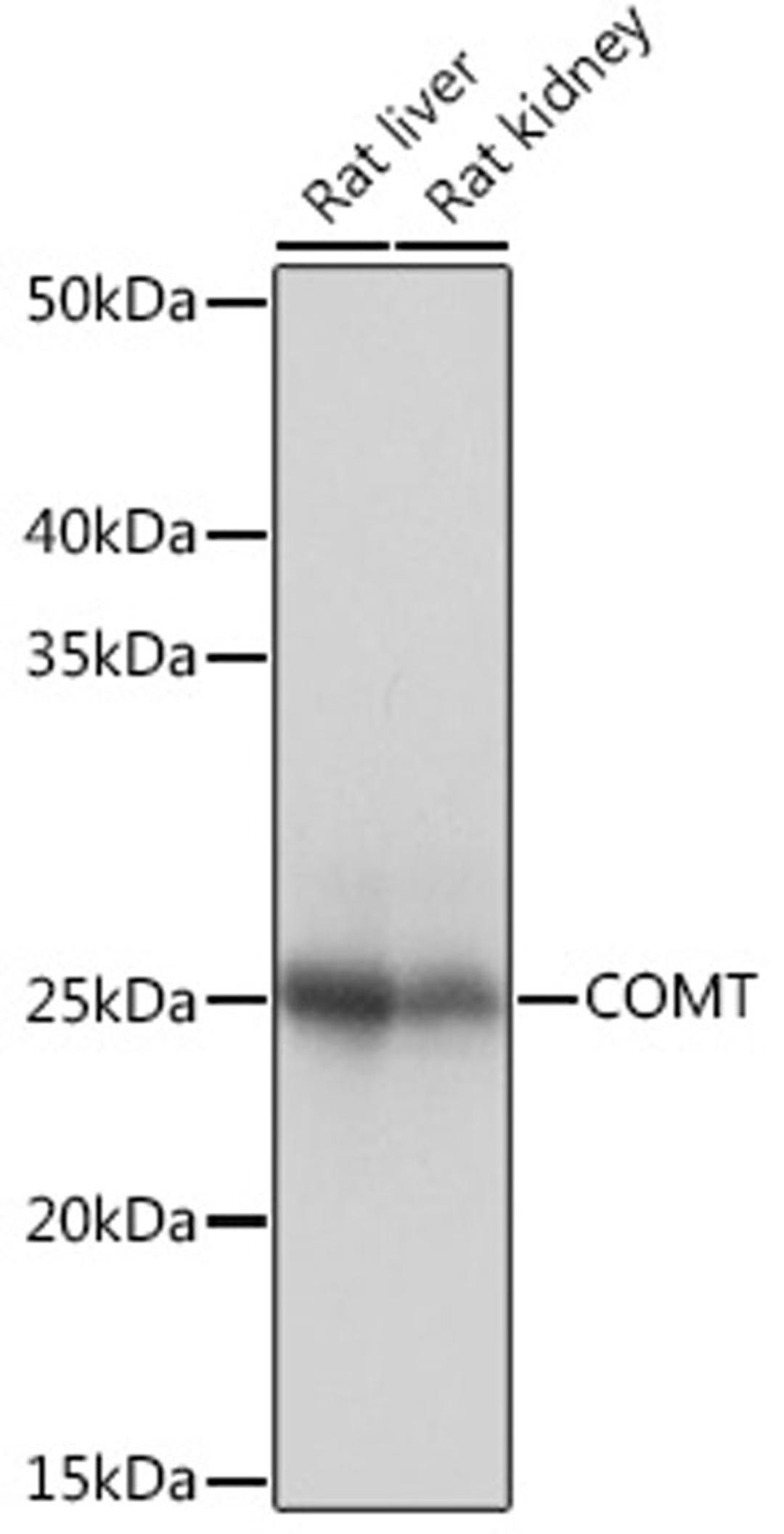 Western blot - COMT Rabbit mAb (A4435)