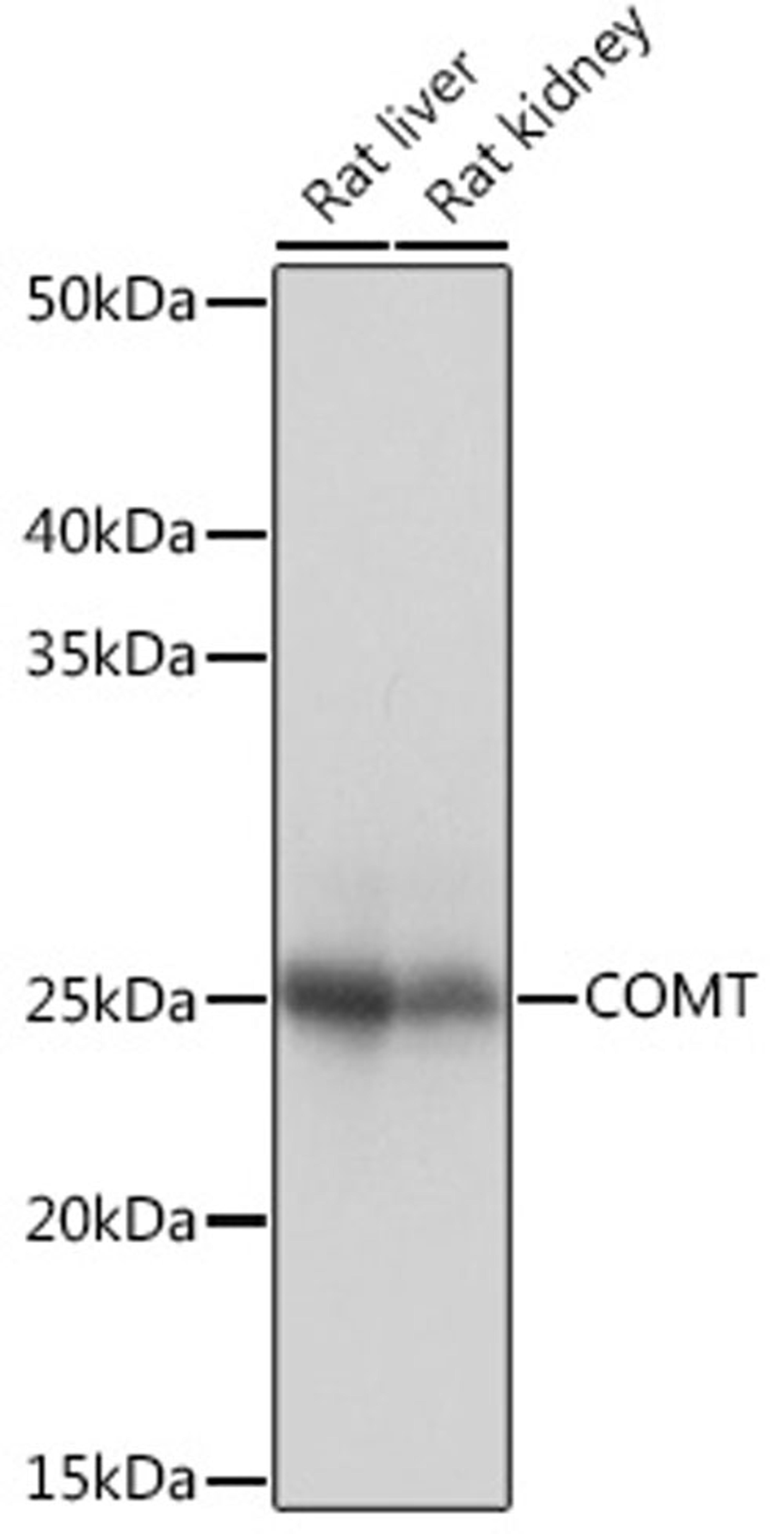 Western blot - COMT Rabbit mAb (A4435)