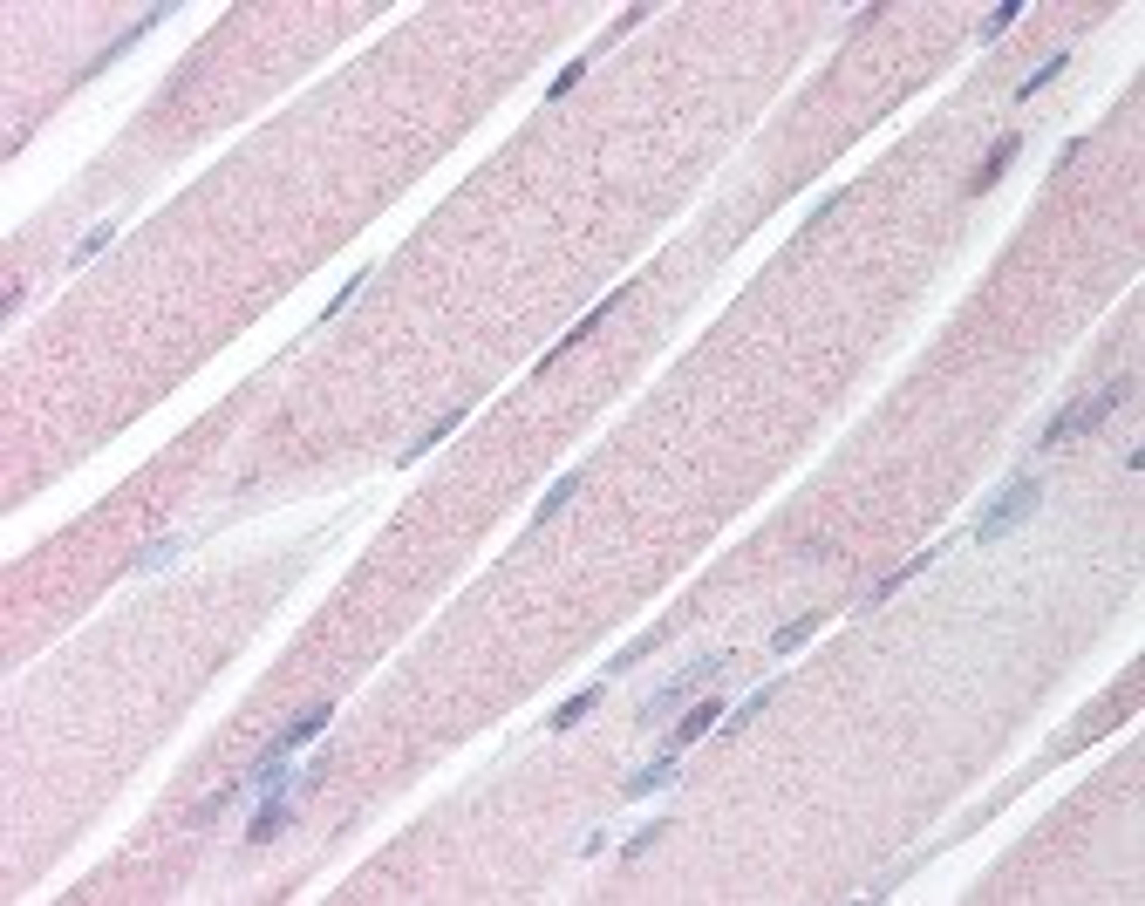 Immunohistochemistry staining of KAL1 in skeletal muscle tissue using KAL1 Antibody.