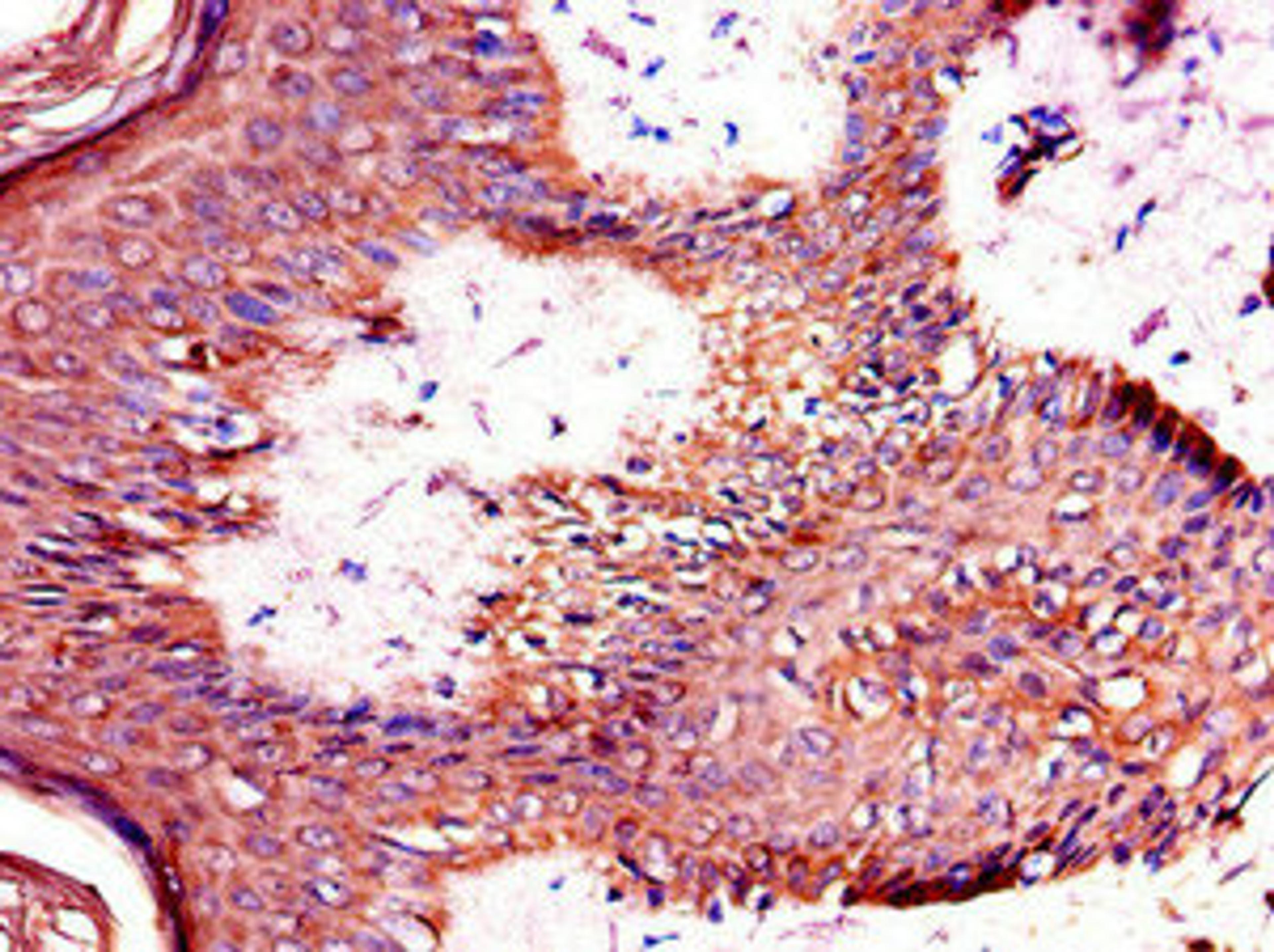 Immunohistochemistry of paraffin-embedded human skin tissue using CSB-PA023116LA01HU at dilution of 1:100
