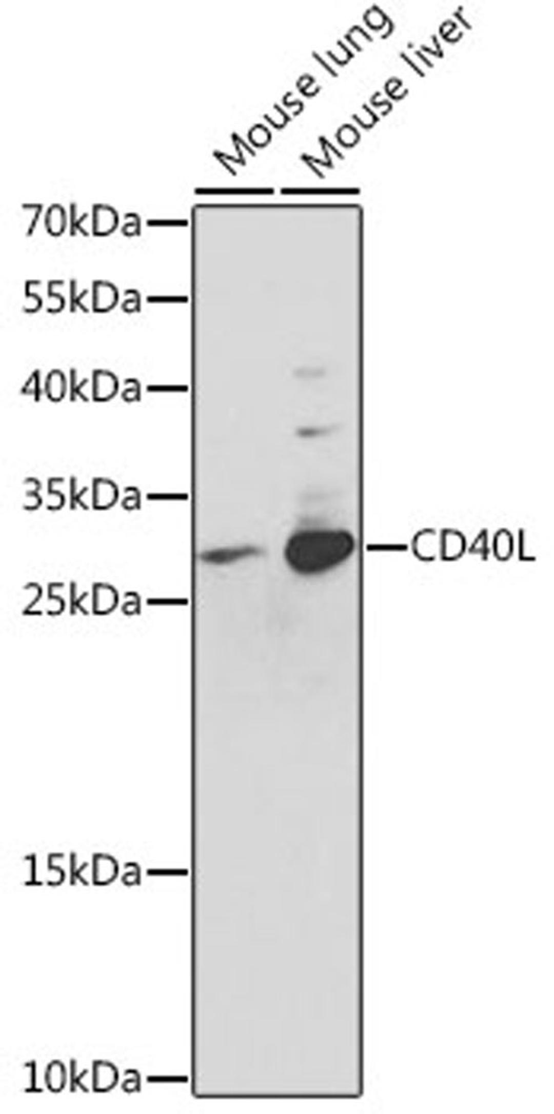 Western blot - CD40L antibody (A0327)