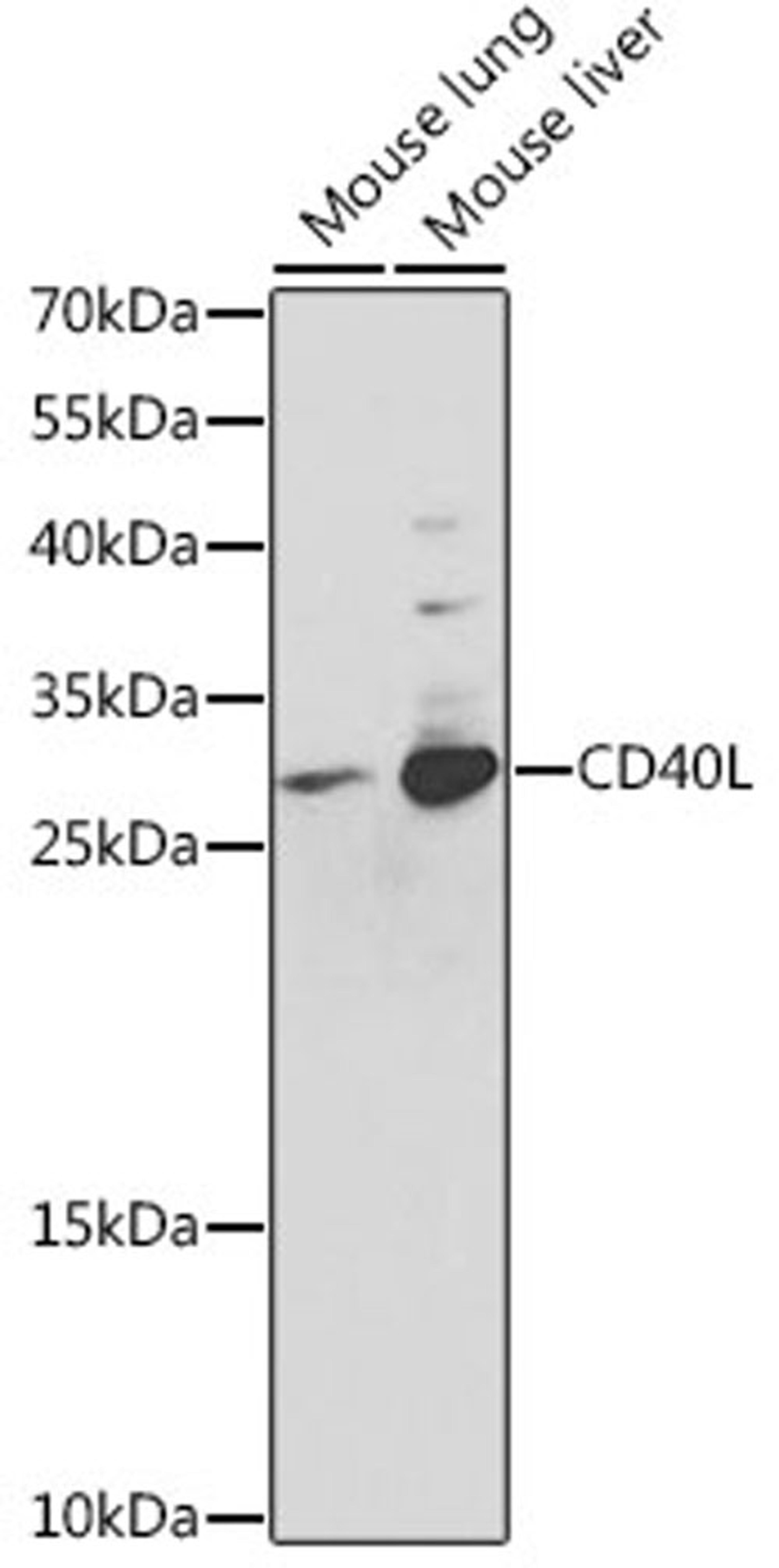 Western blot - CD40L antibody (A0327)